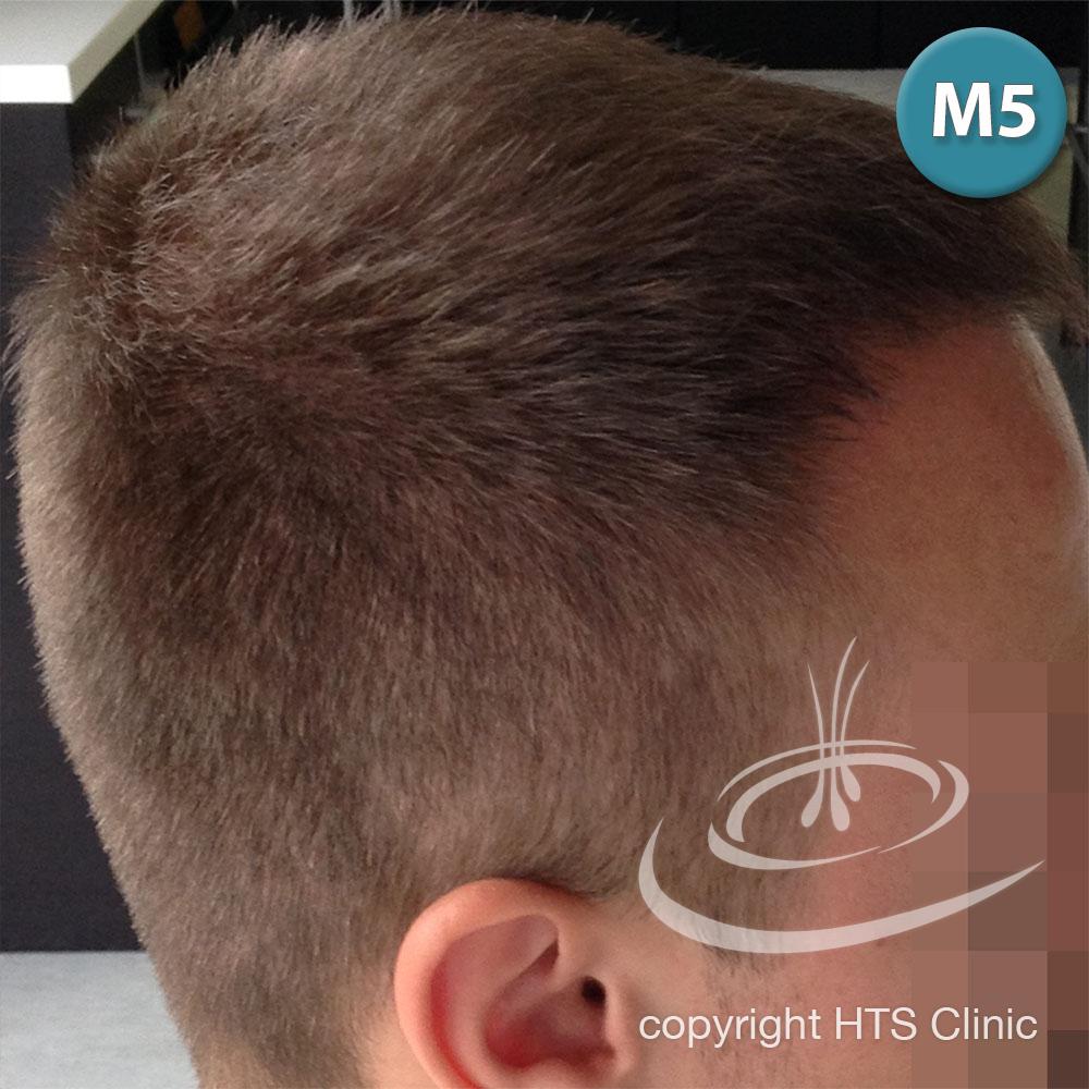 /foren/transplant/index.php?t=getfile&id=39628&private=0