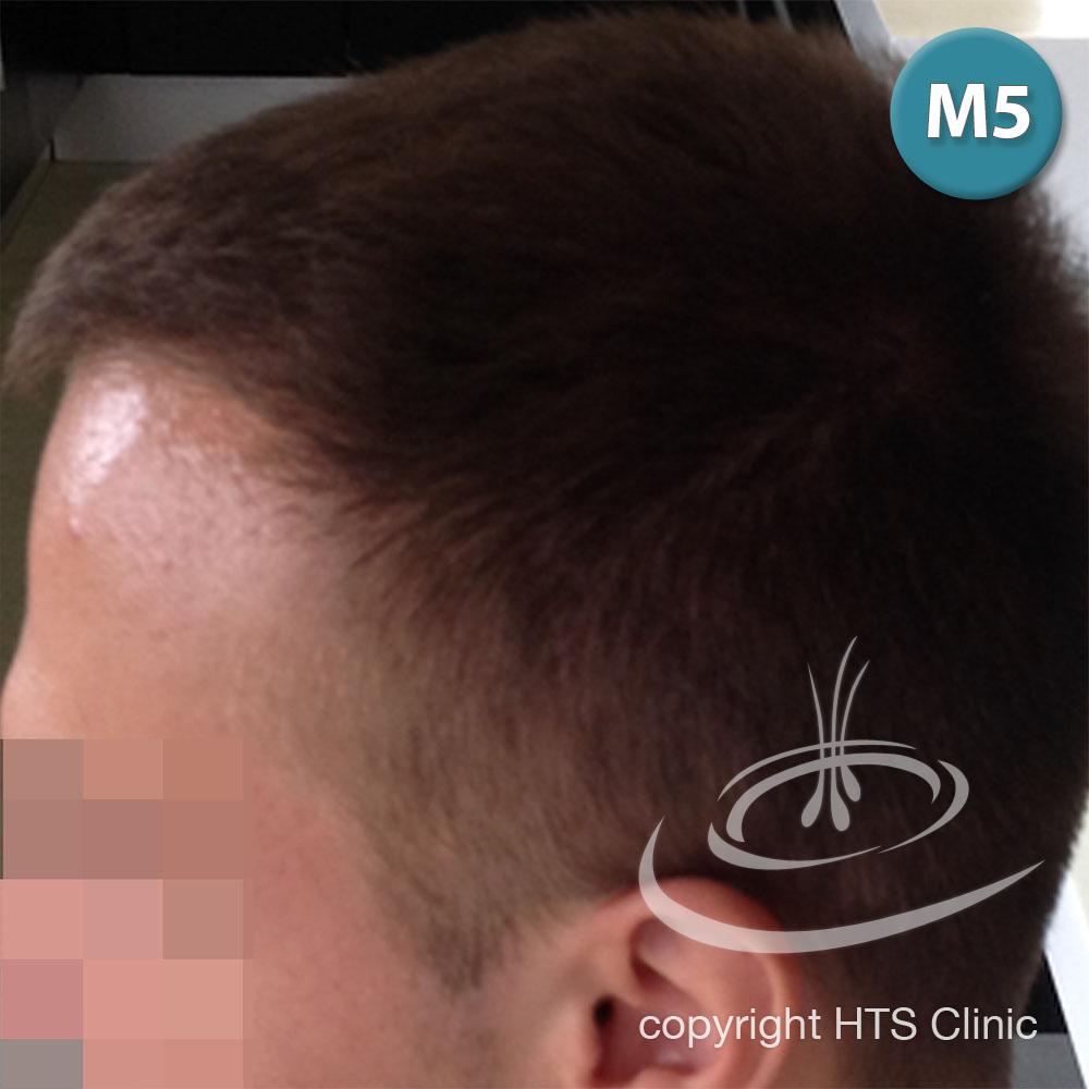 /foren/transplant/index.php?t=getfile&id=39629&private=0