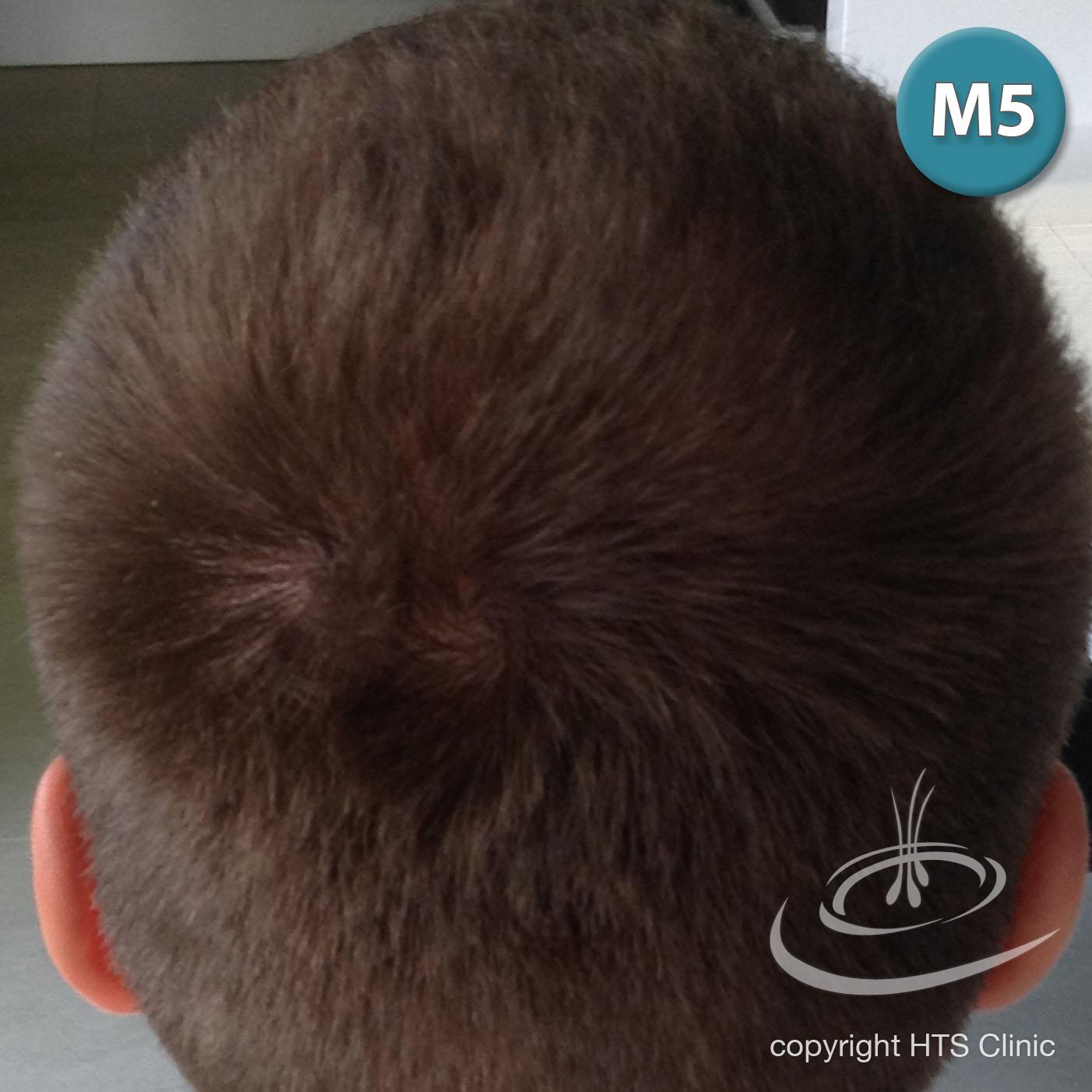 /foren/transplant/index.php?t=getfile&id=39630&private=0