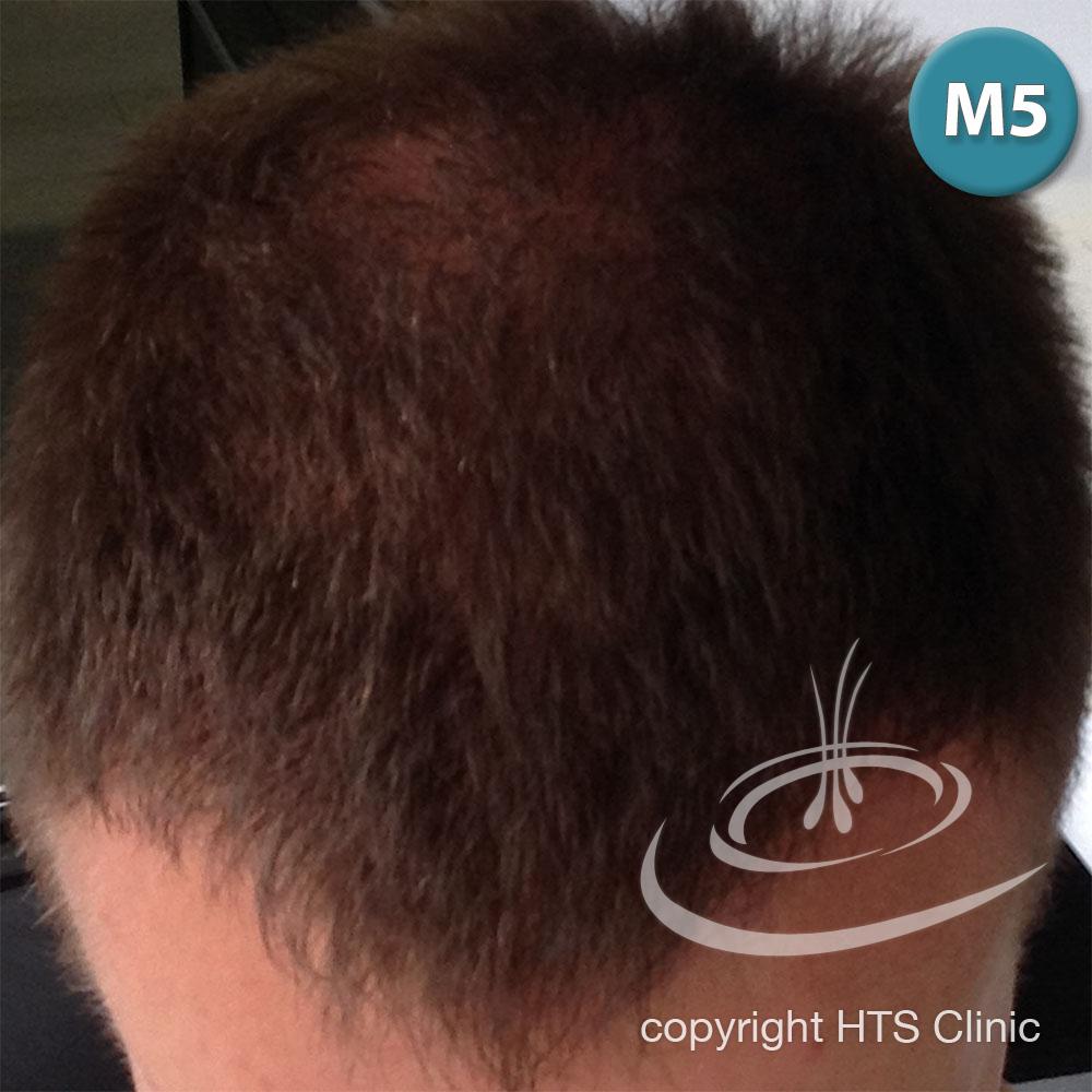 /foren/transplant/index.php?t=getfile&id=39631&private=0