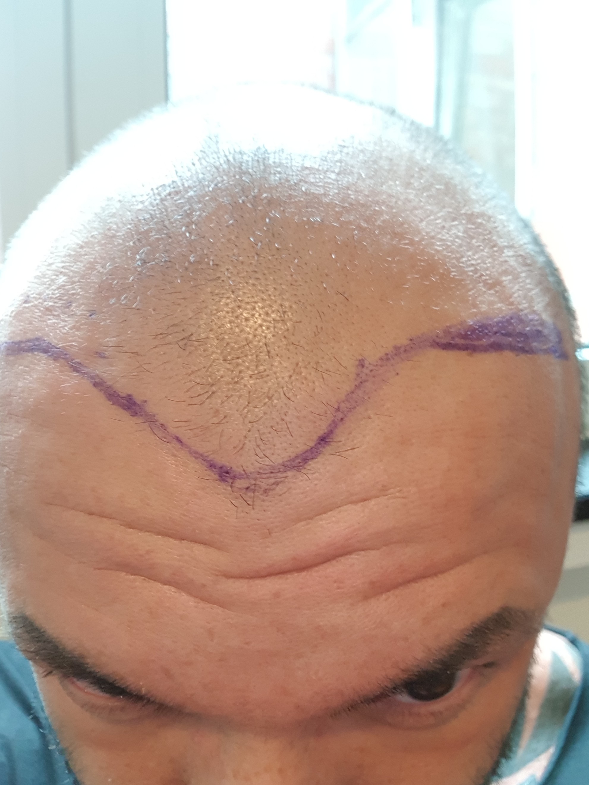 /foren/transplant/index.php?t=getfile&id=39765&private=0