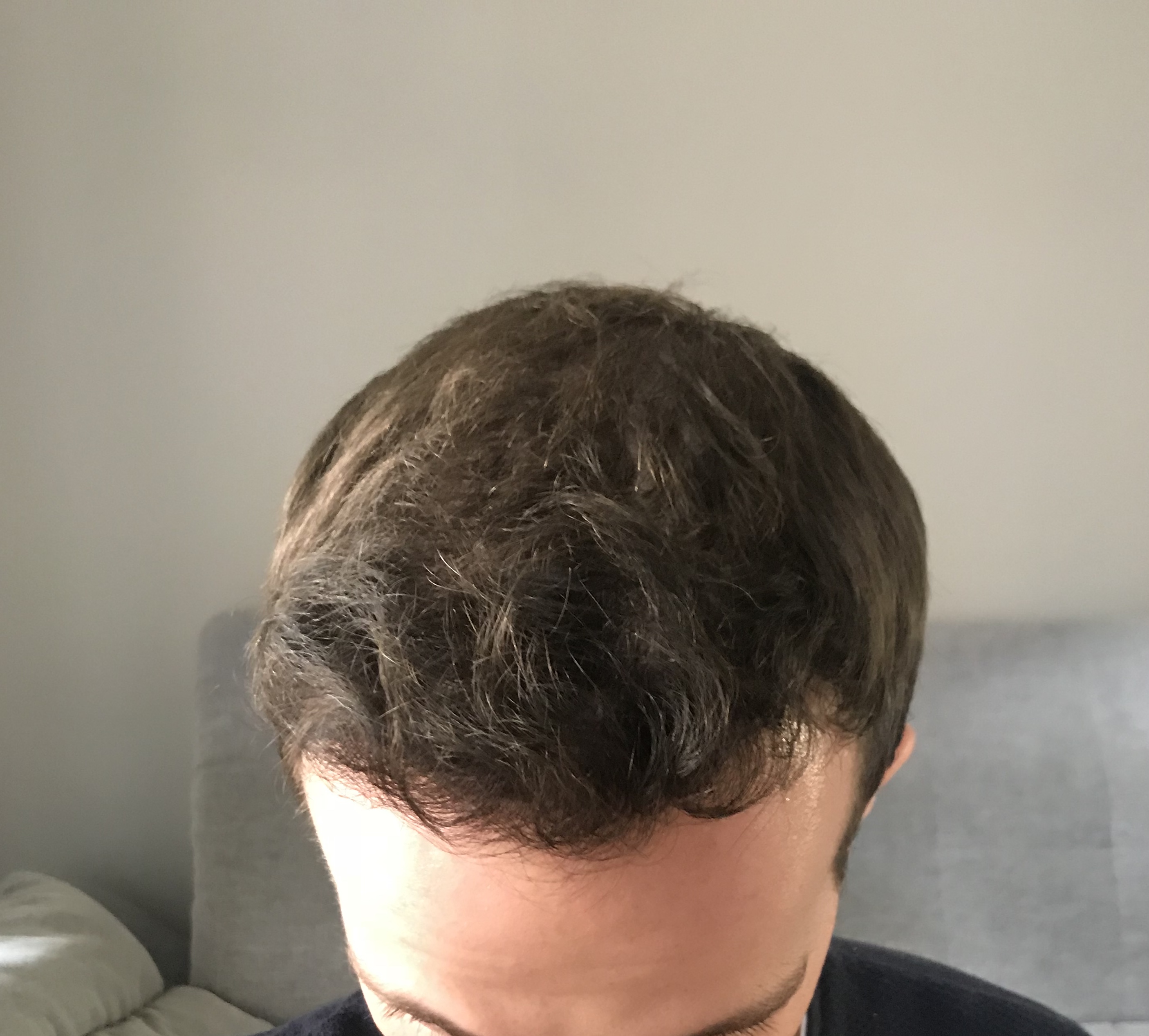 /foren/transplant/index.php?t=getfile&id=39835&private=0