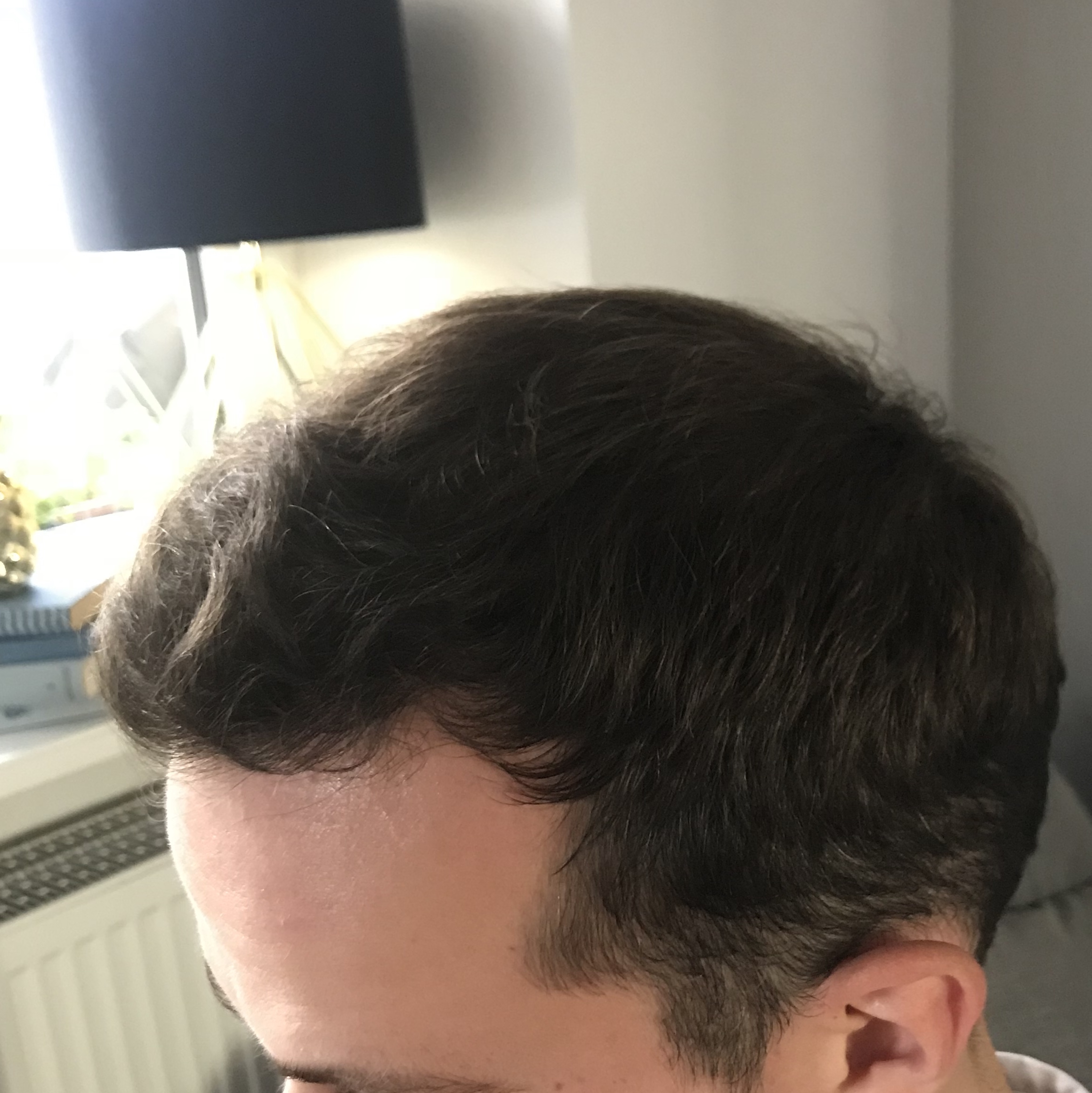 /foren/transplant/index.php?t=getfile&id=39837&private=0