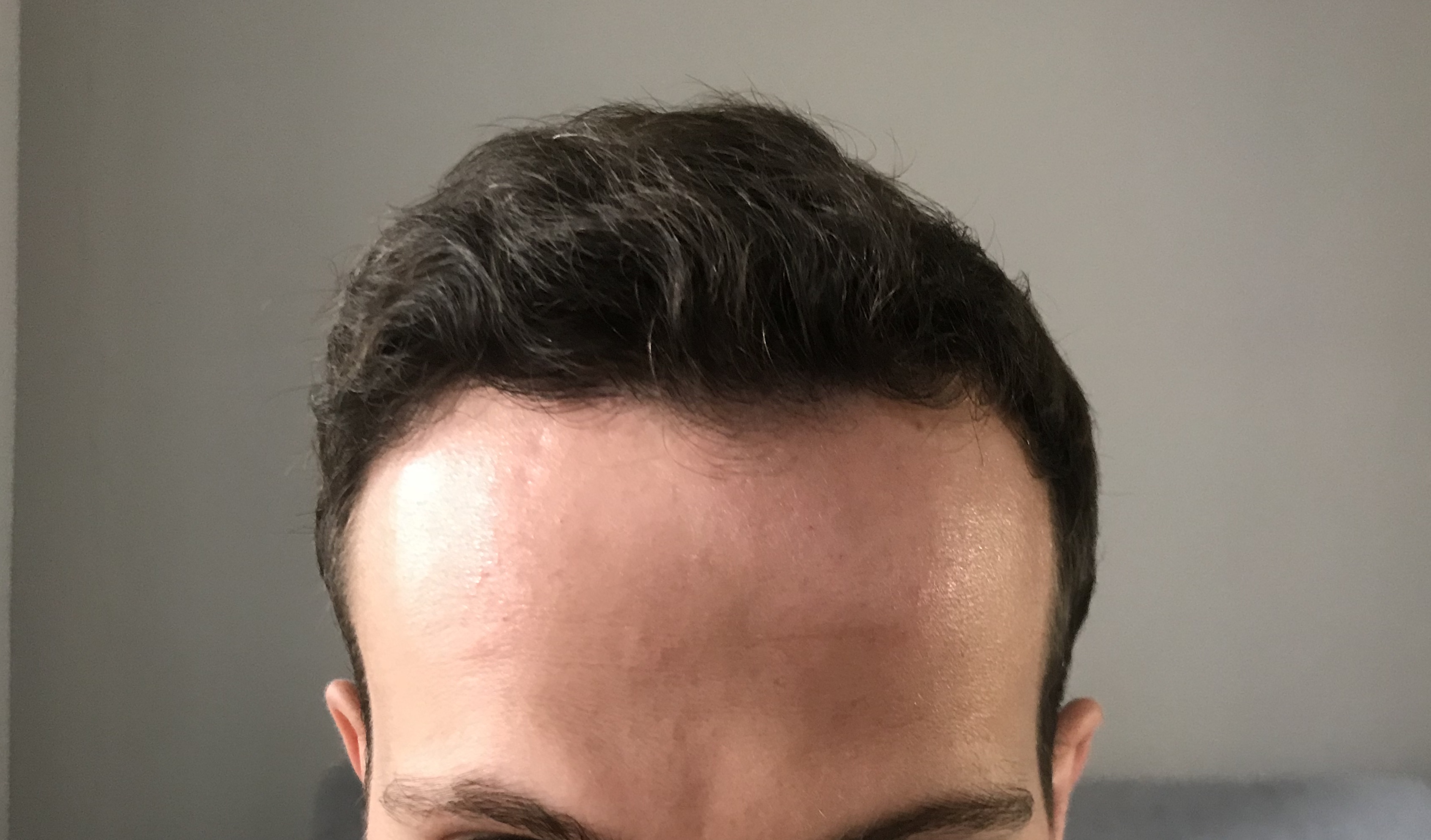 /foren/transplant/index.php?t=getfile&id=39838&private=0