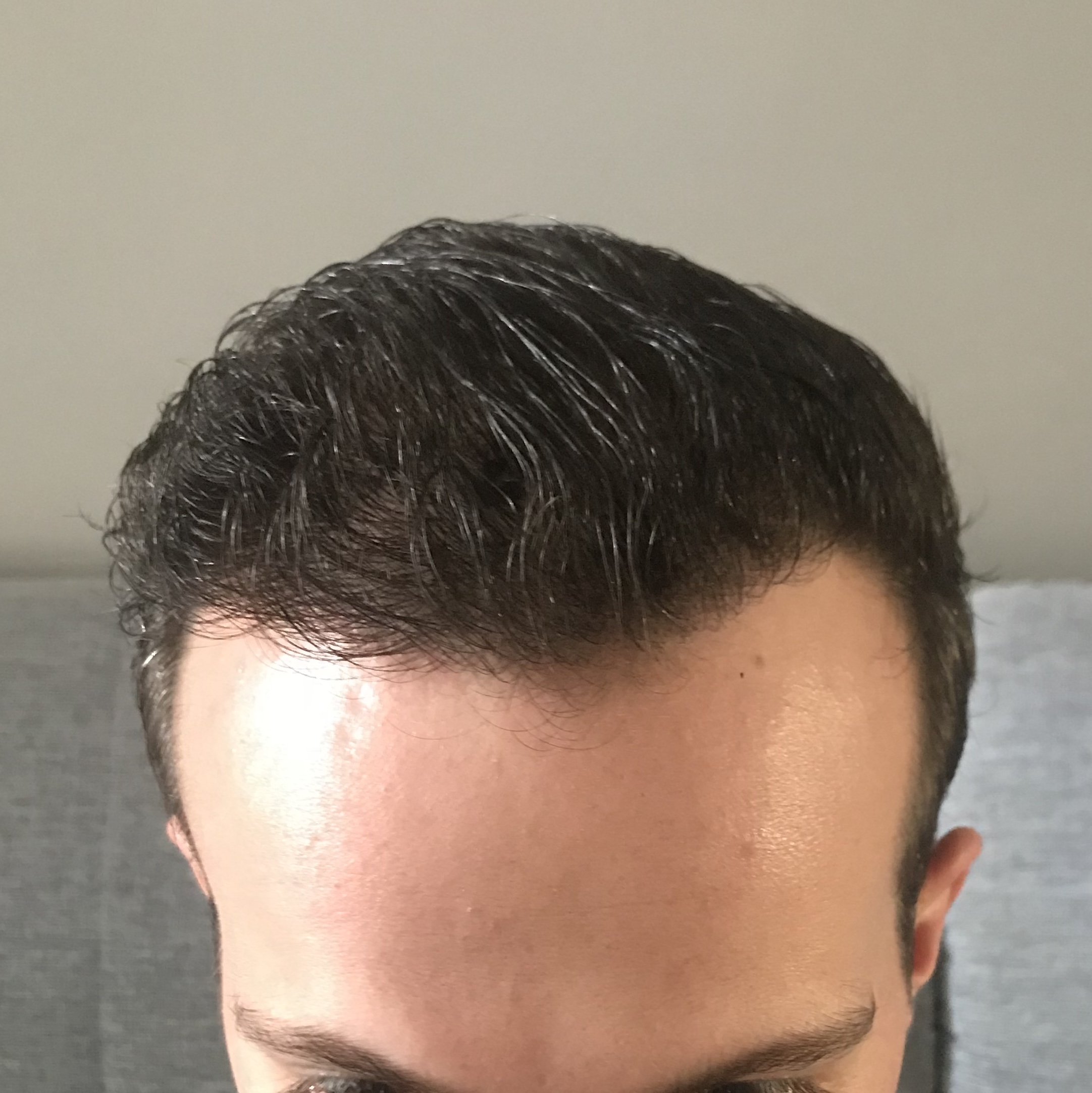 /foren/transplant/index.php?t=getfile&id=39839&private=0