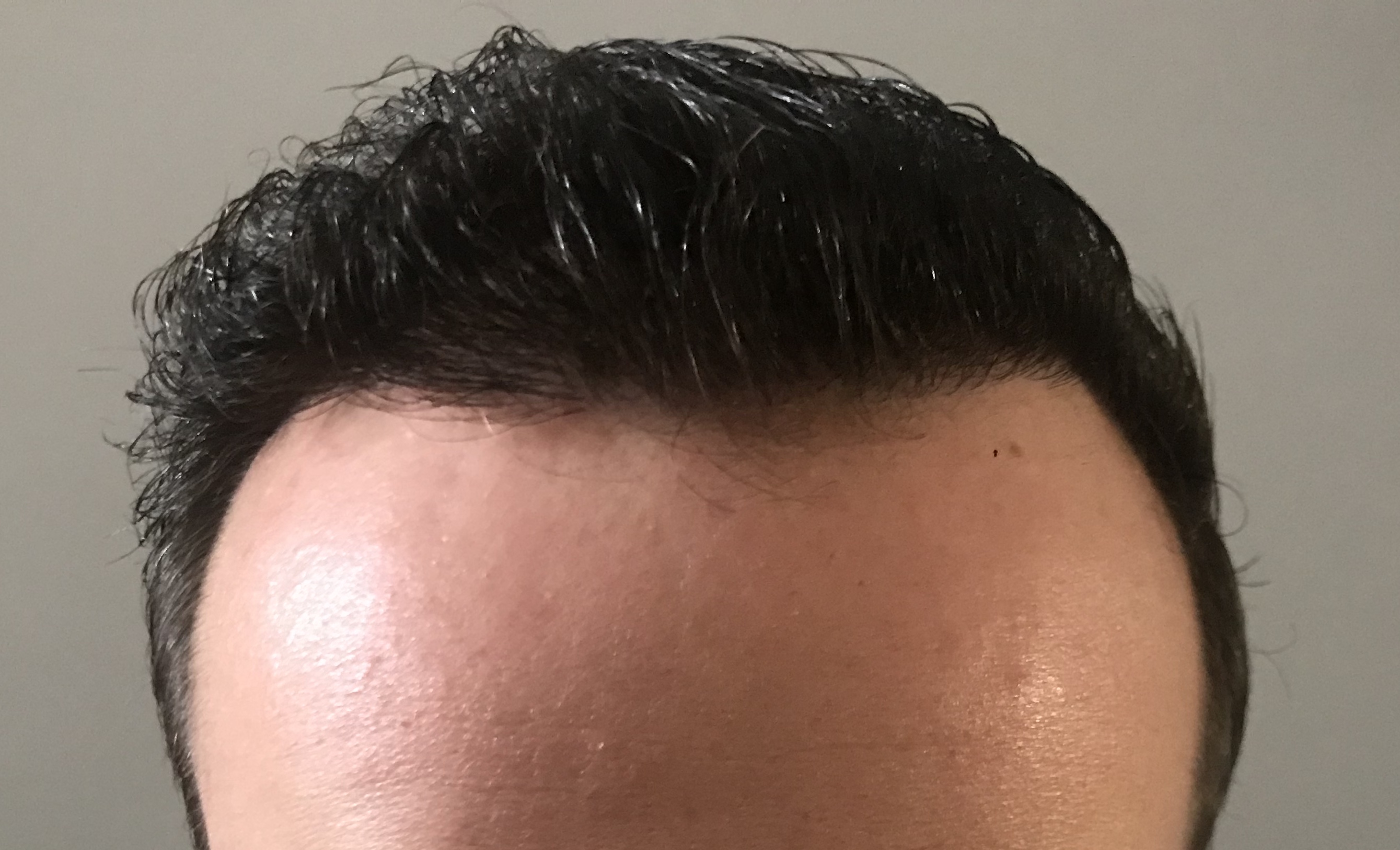 /foren/transplant/index.php?t=getfile&id=39842&private=0