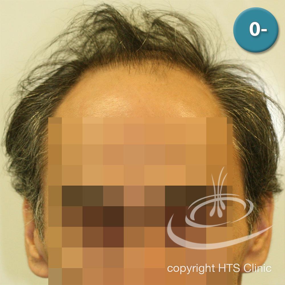 /foren/transplant/index.php?t=getfile&id=39863&private=0