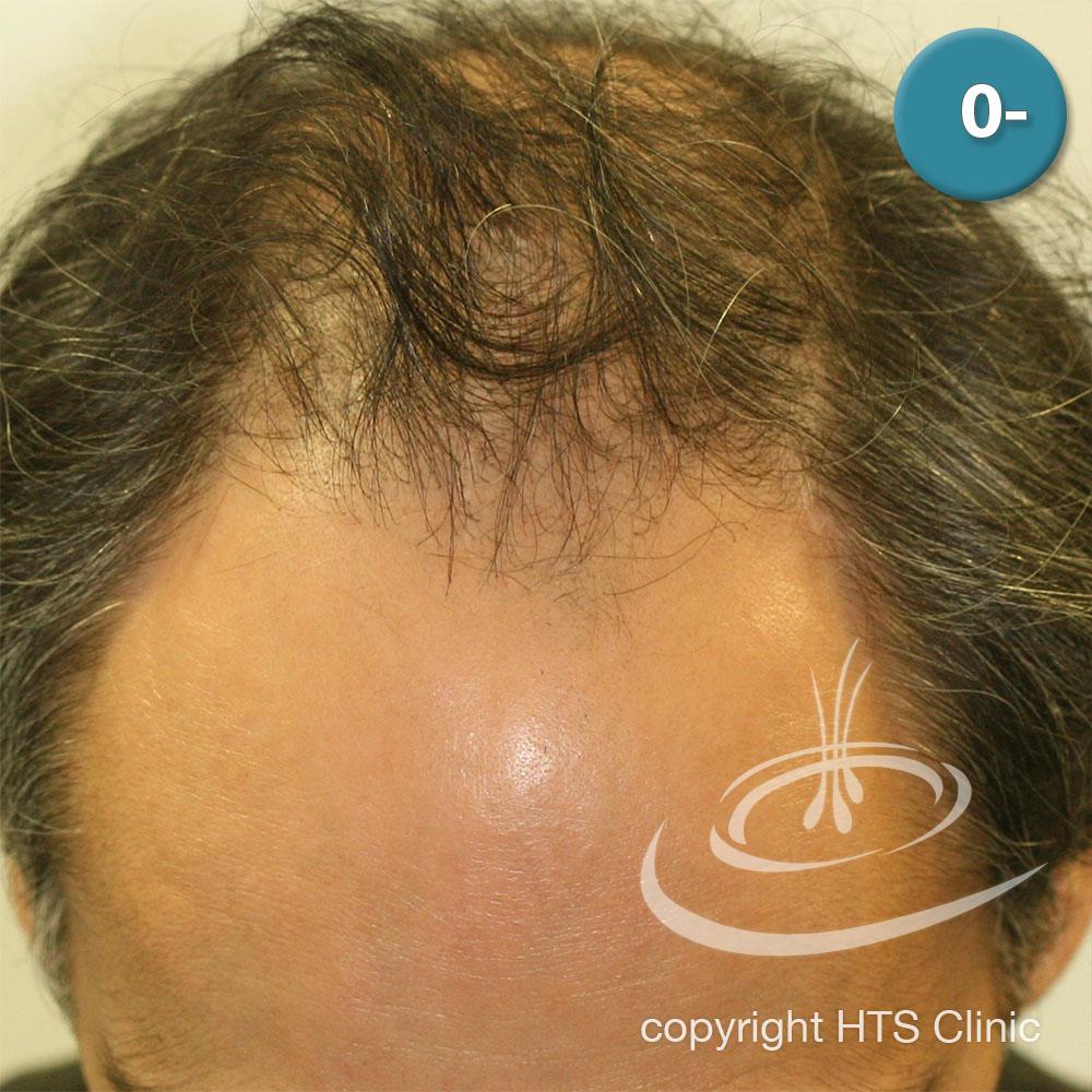 /foren/transplant/index.php?t=getfile&id=39864&private=0