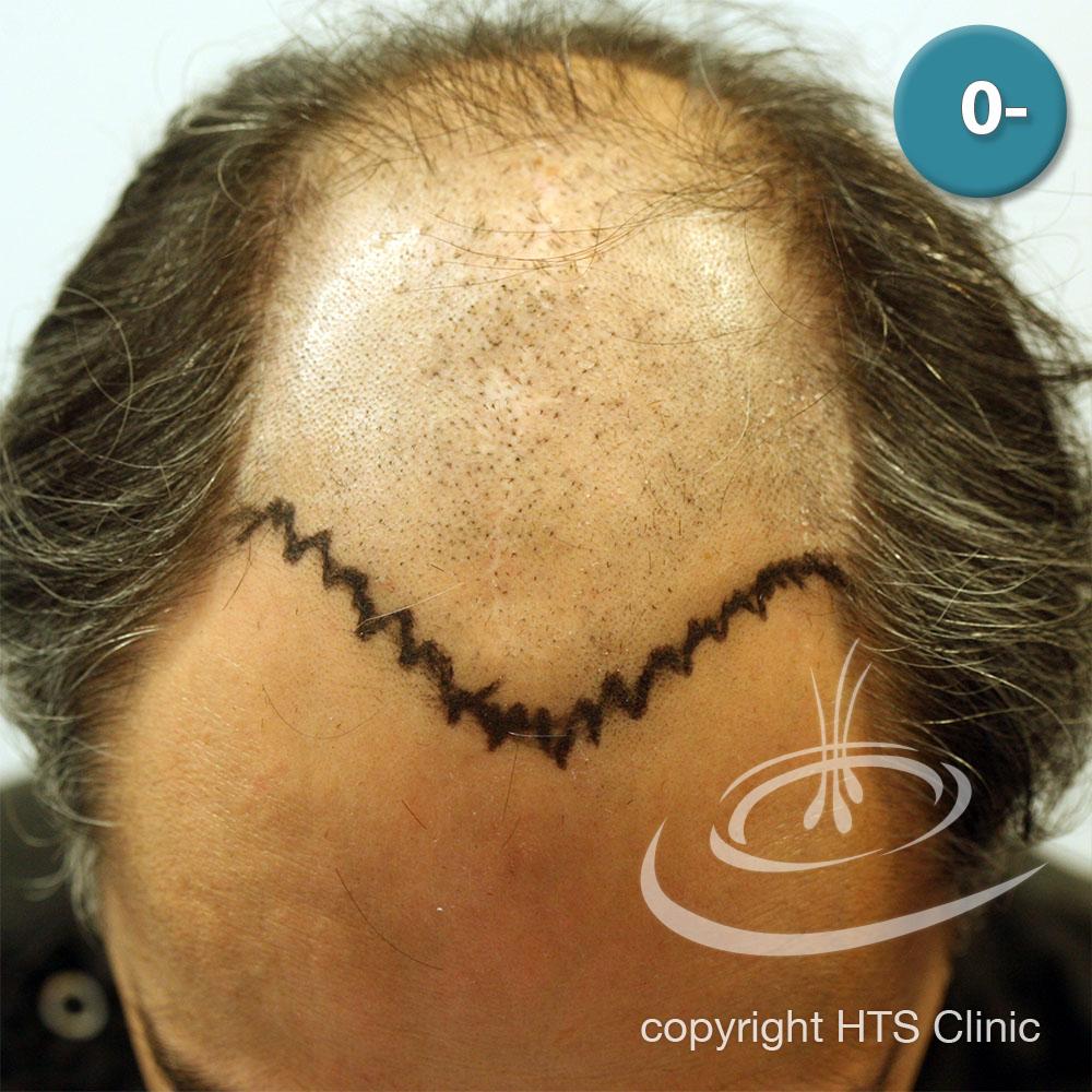 /foren/transplant/index.php?t=getfile&id=39865&private=0