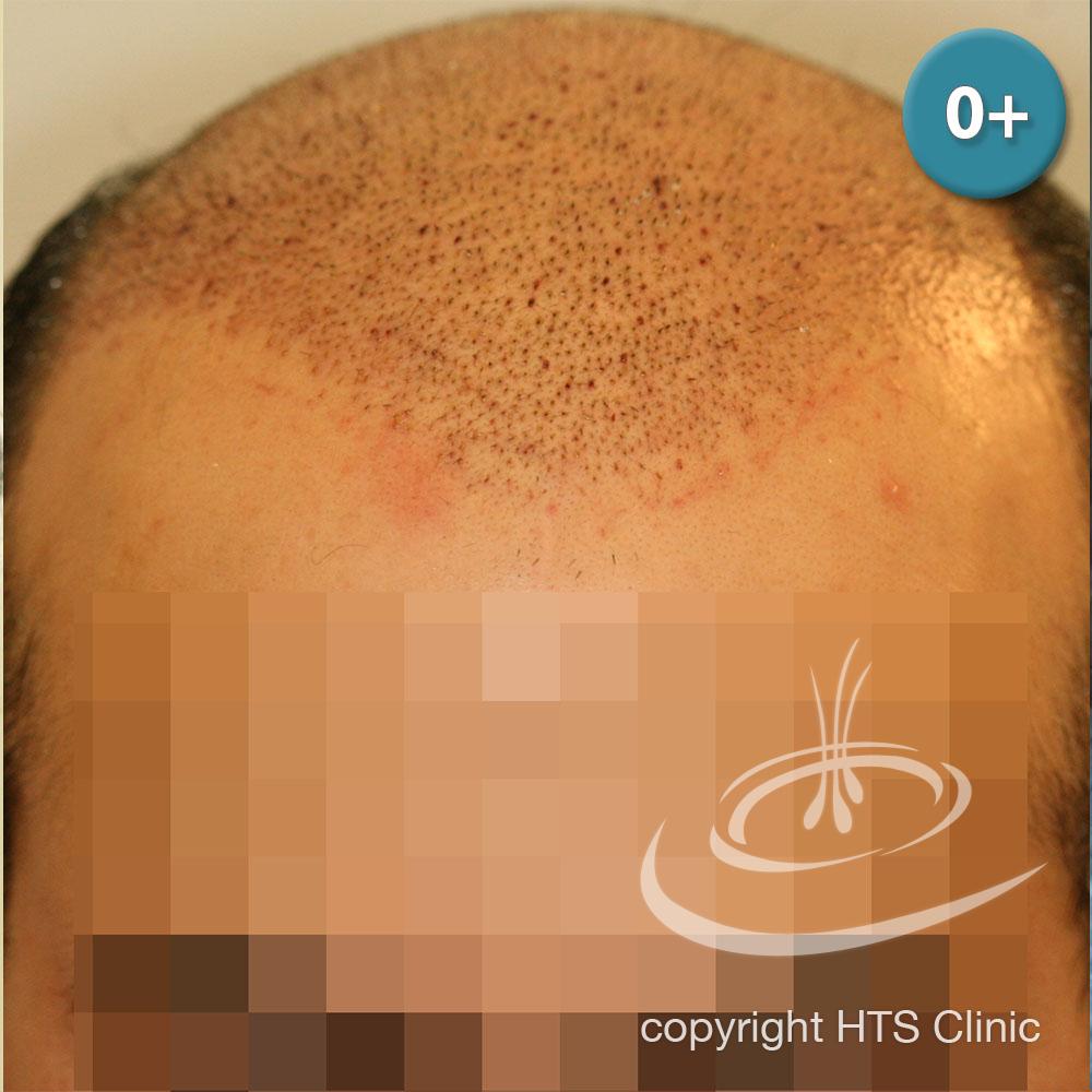 /foren/transplant/index.php?t=getfile&id=39866&private=0