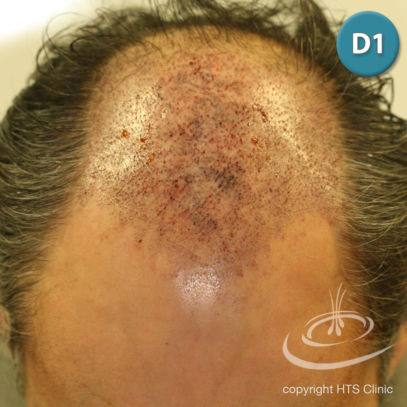 /foren/transplant/index.php?t=getfile&id=39867&private=0