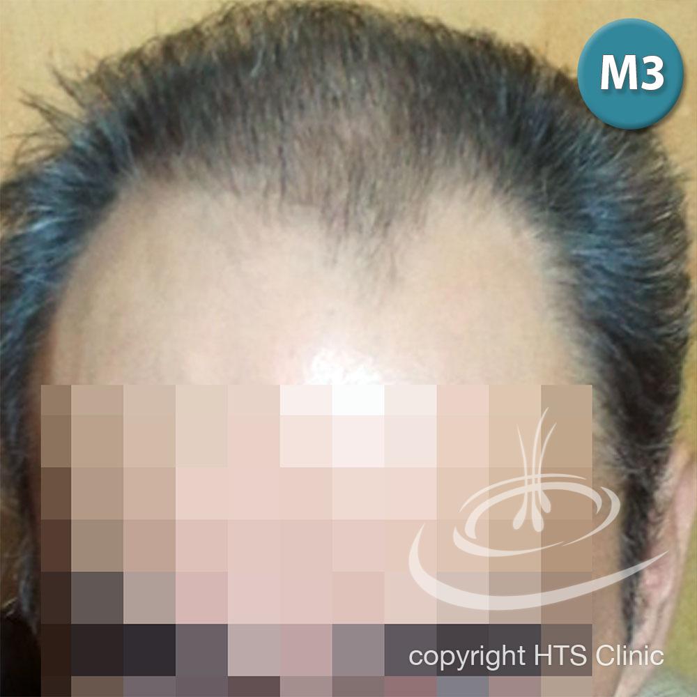 /foren/transplant/index.php?t=getfile&id=39868&private=0