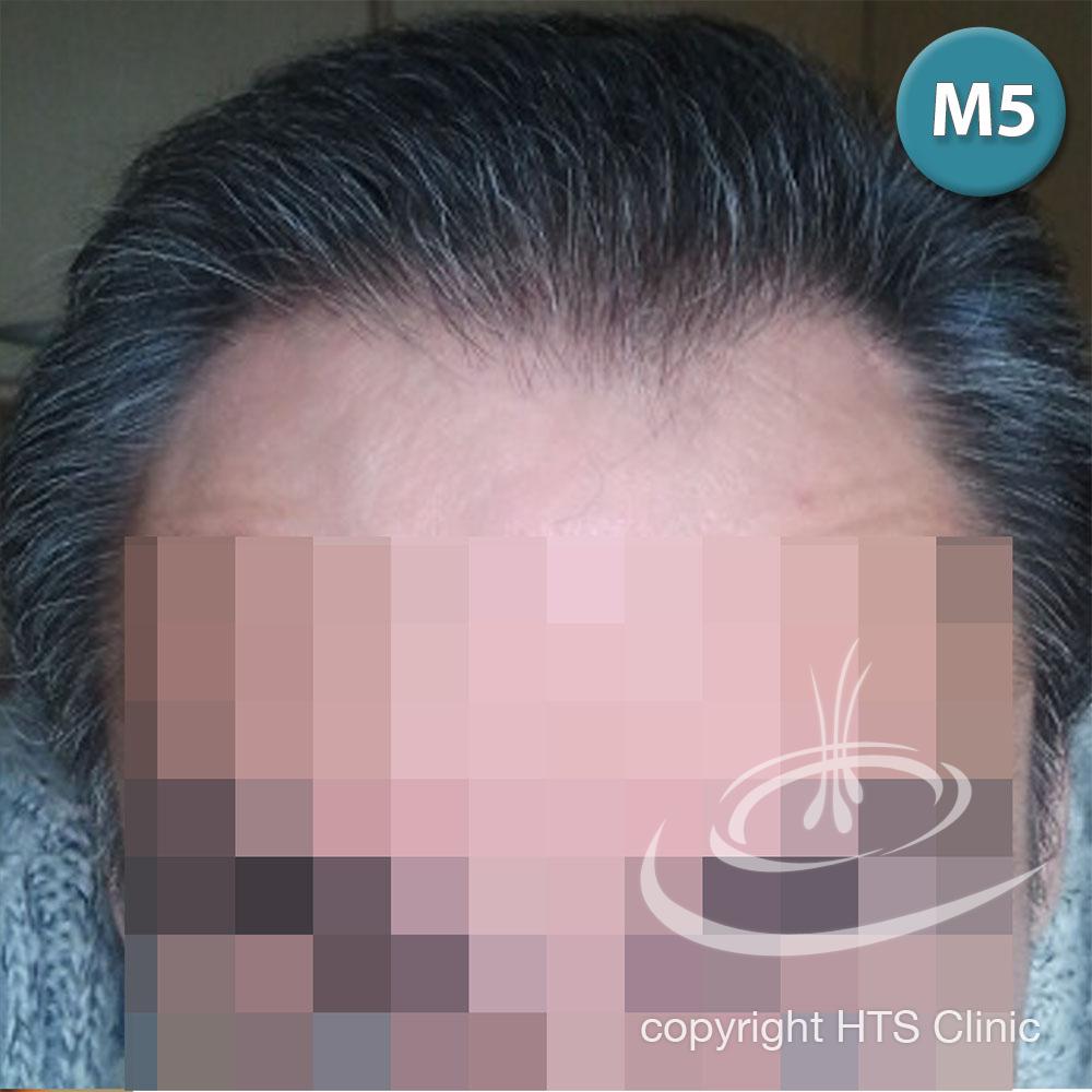 /foren/transplant/index.php?t=getfile&id=39869&private=0