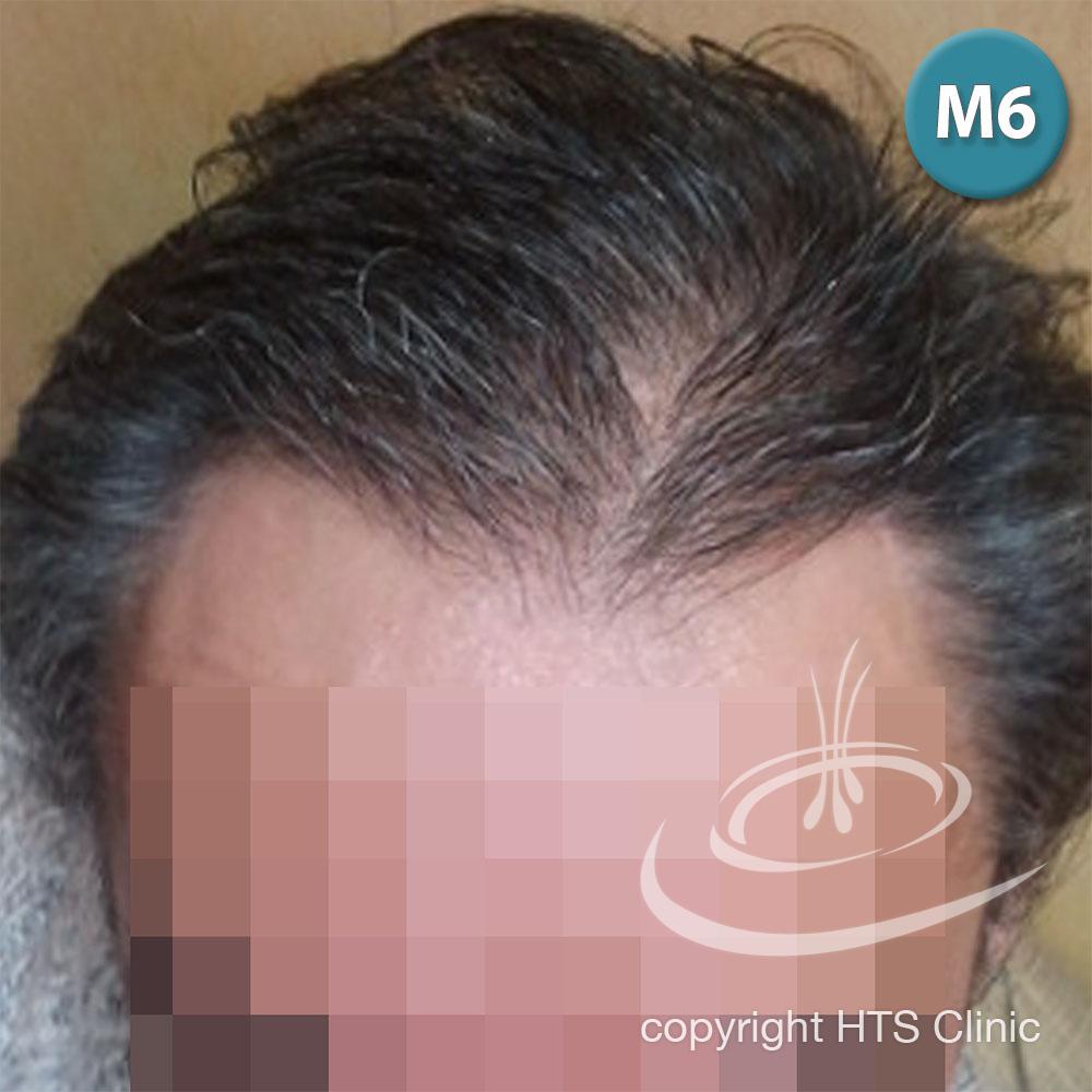 /foren/transplant/index.php?t=getfile&id=39870&private=0