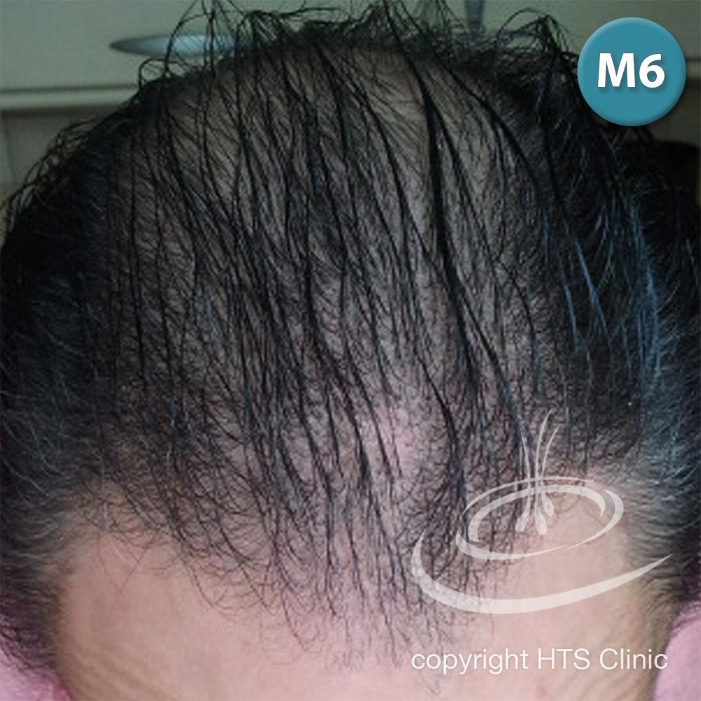 /foren/transplant/index.php?t=getfile&id=39871&private=0