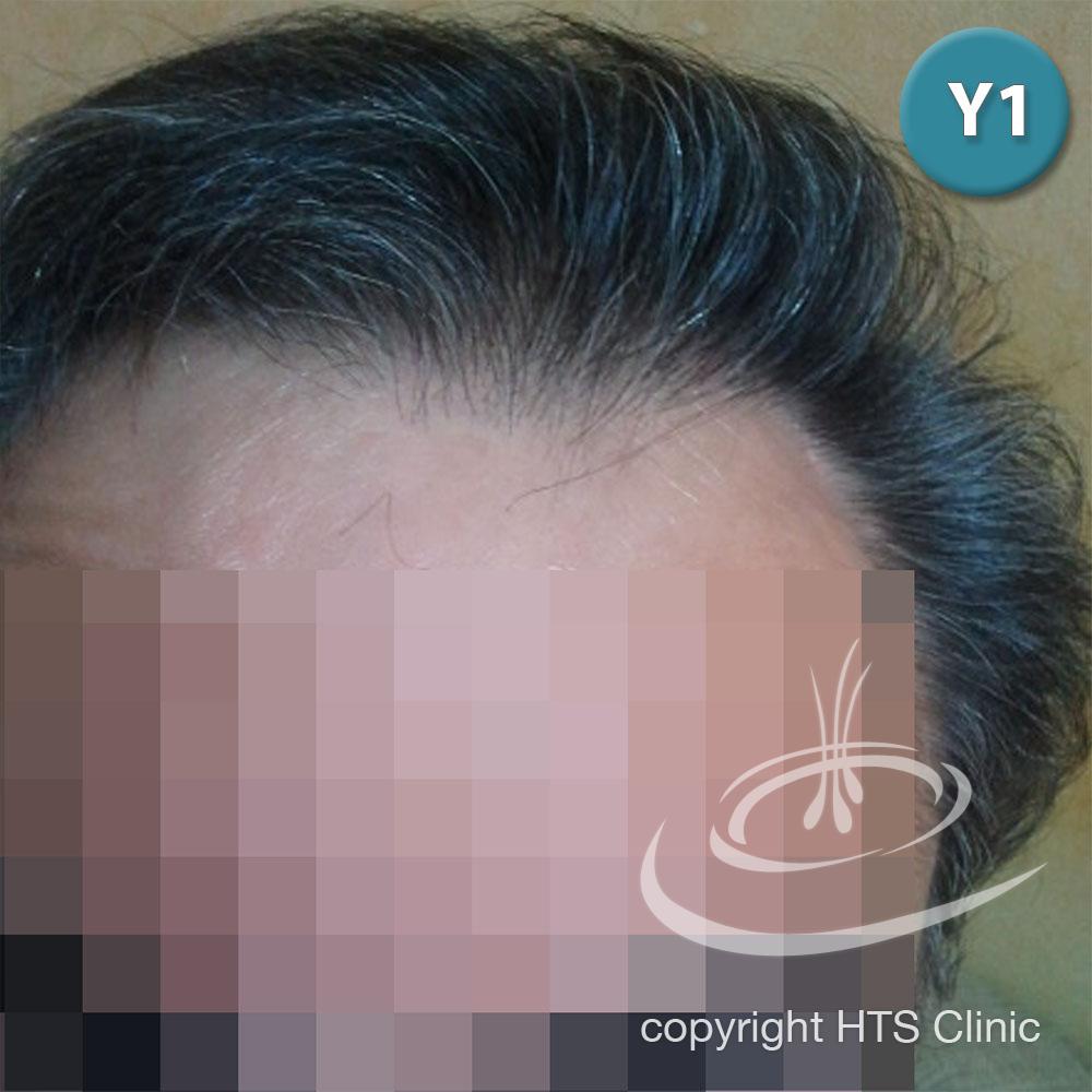 /foren/transplant/index.php?t=getfile&id=39872&private=0