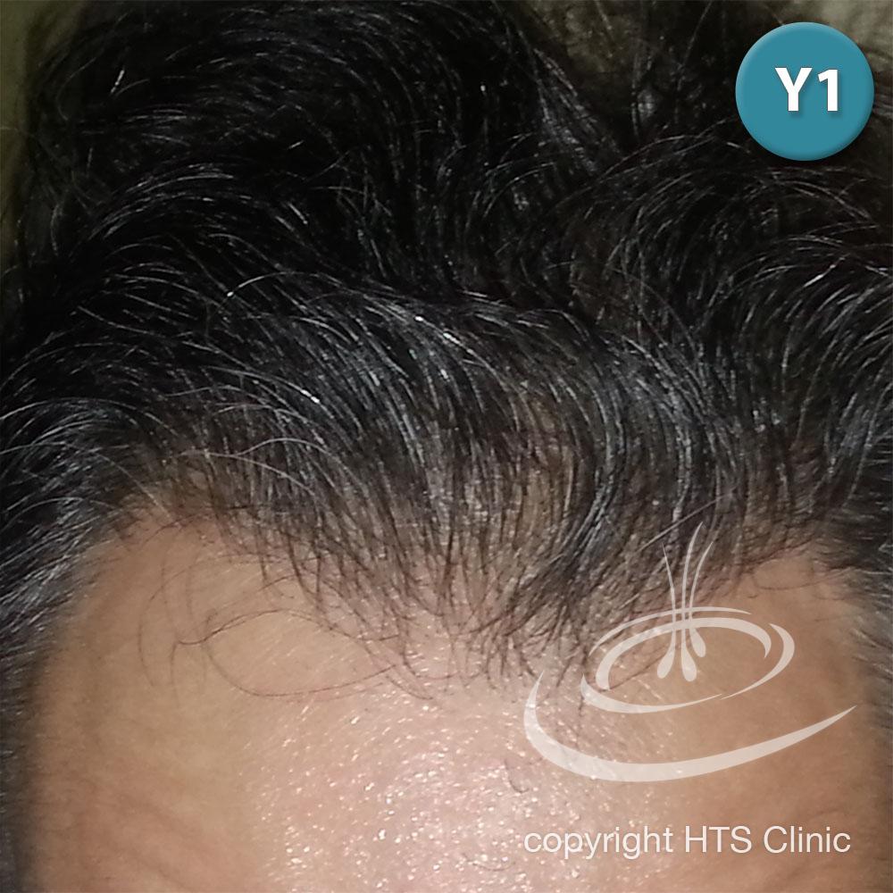 /foren/transplant/index.php?t=getfile&id=39873&private=0