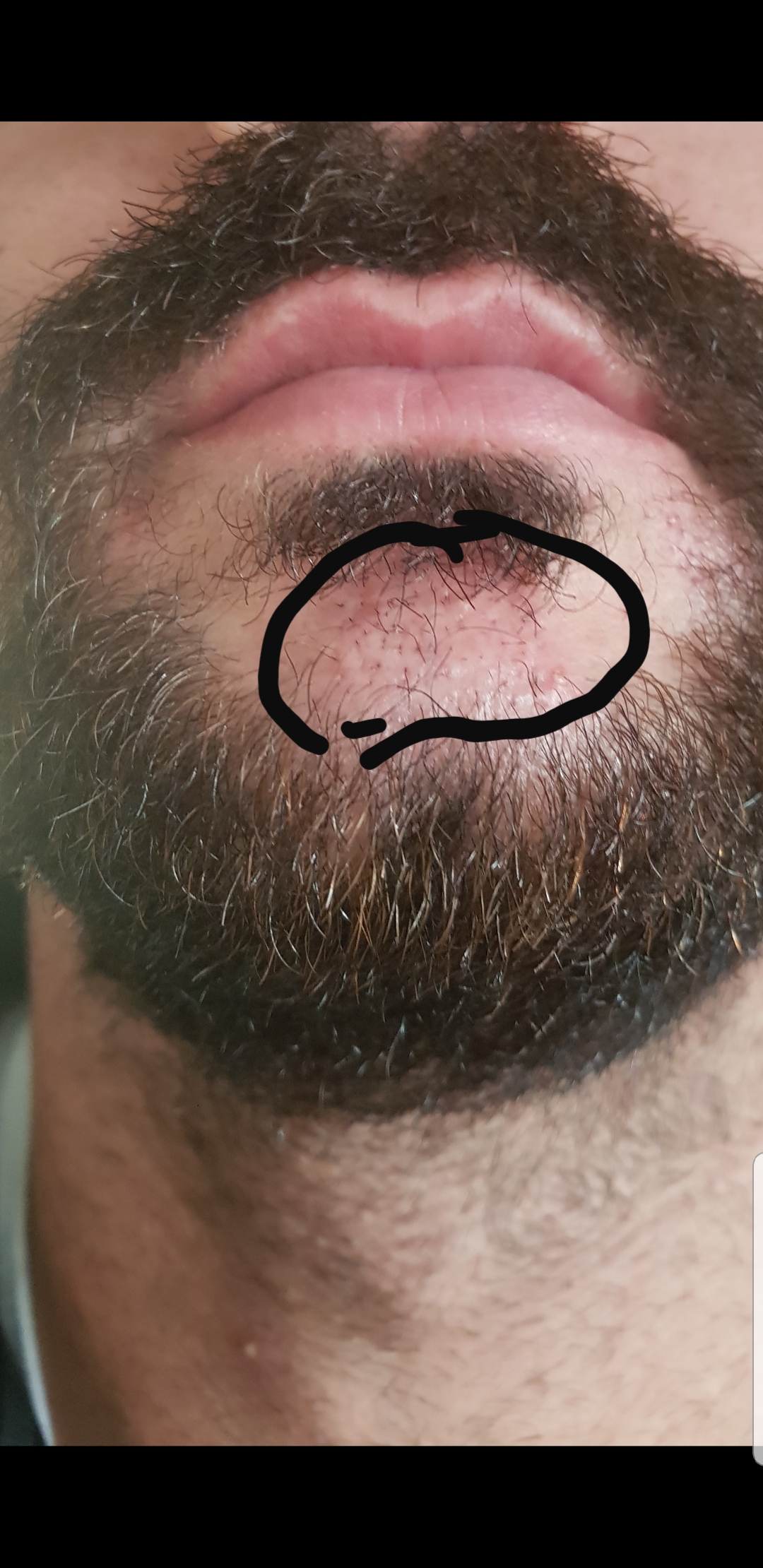 /foren/transplant/index.php?t=getfile&id=40142&private=0