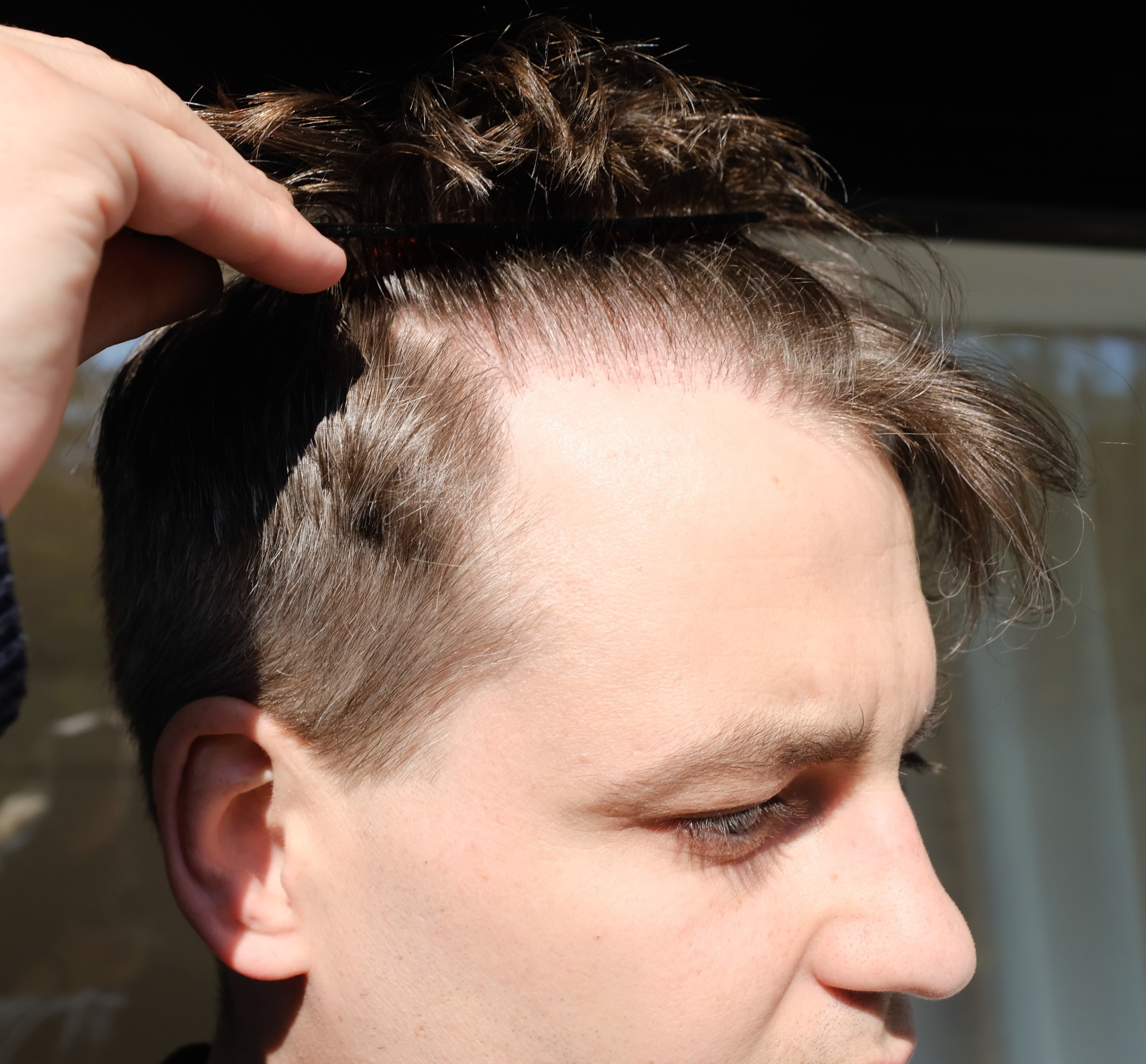 /foren/transplant/index.php?t=getfile&id=40205&private=0