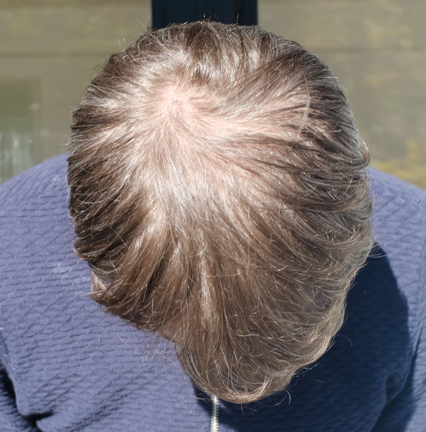 /foren/transplant/index.php?t=getfile&id=40208&private=0