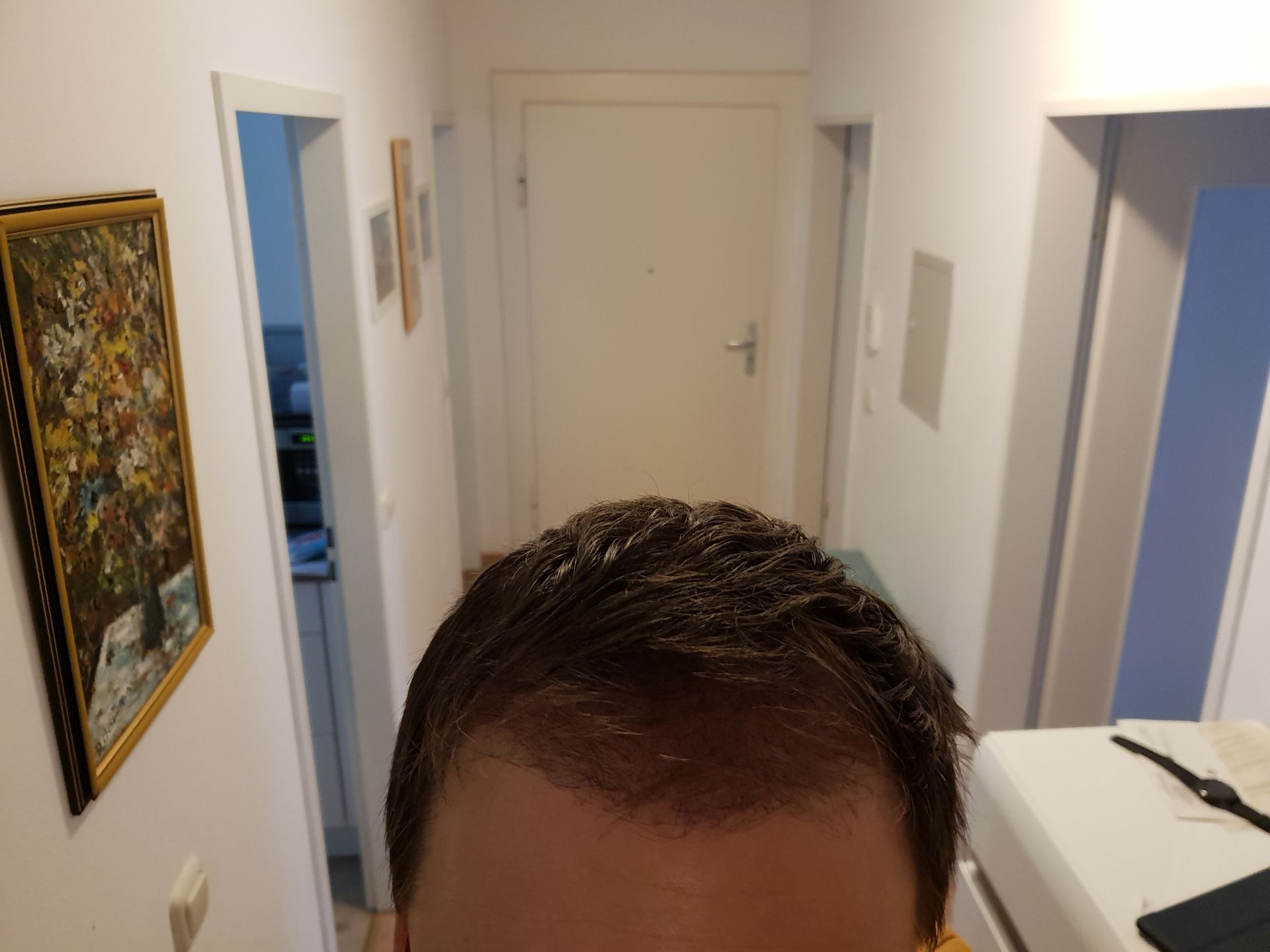 /foren/transplant/index.php?t=getfile&id=40369&private=0