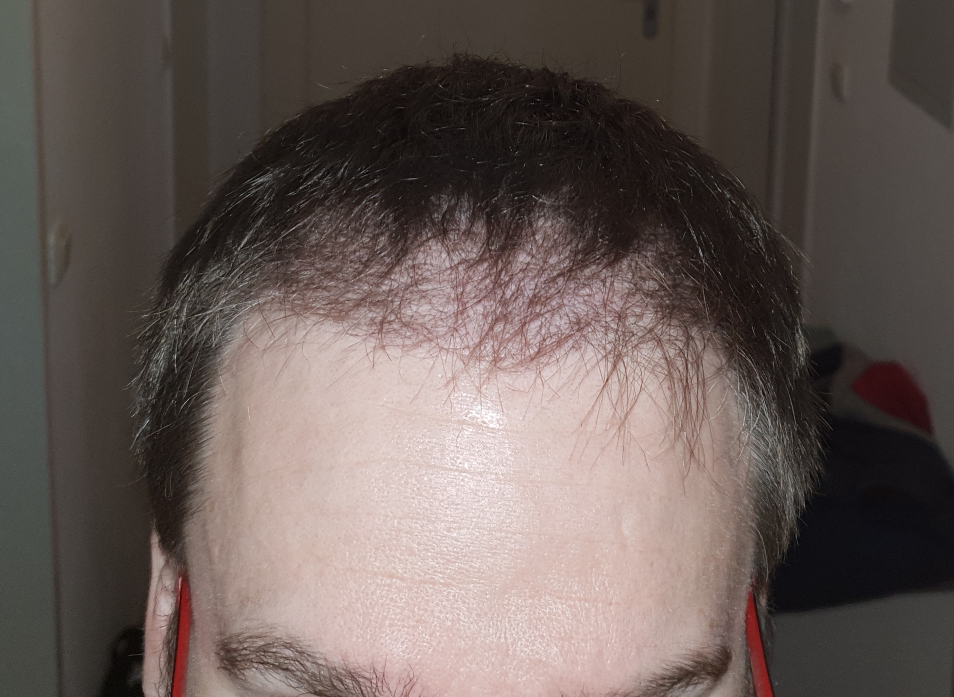 /foren/transplant/index.php?t=getfile&id=40371&private=0