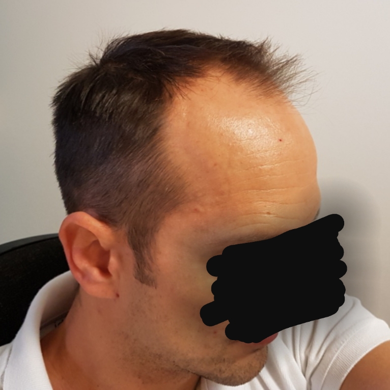 /foren/transplant/index.php?t=getfile&id=40597&private=0