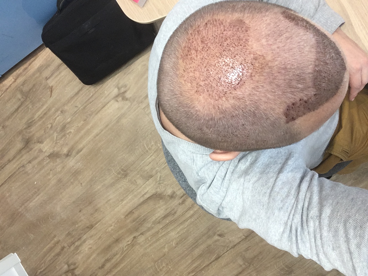 /foren/transplant/index.php?t=getfile&id=40950&private=0