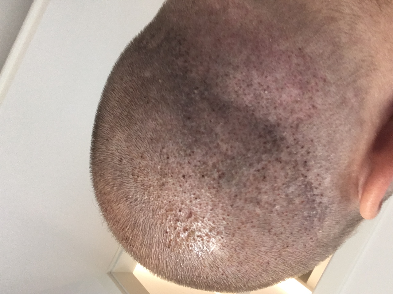 /foren/transplant/index.php?t=getfile&id=40951&private=0