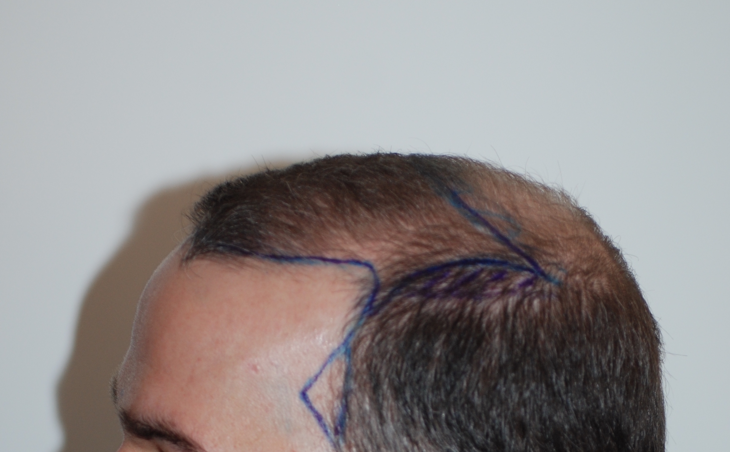 /foren/transplant/index.php?t=getfile&id=40958&private=0