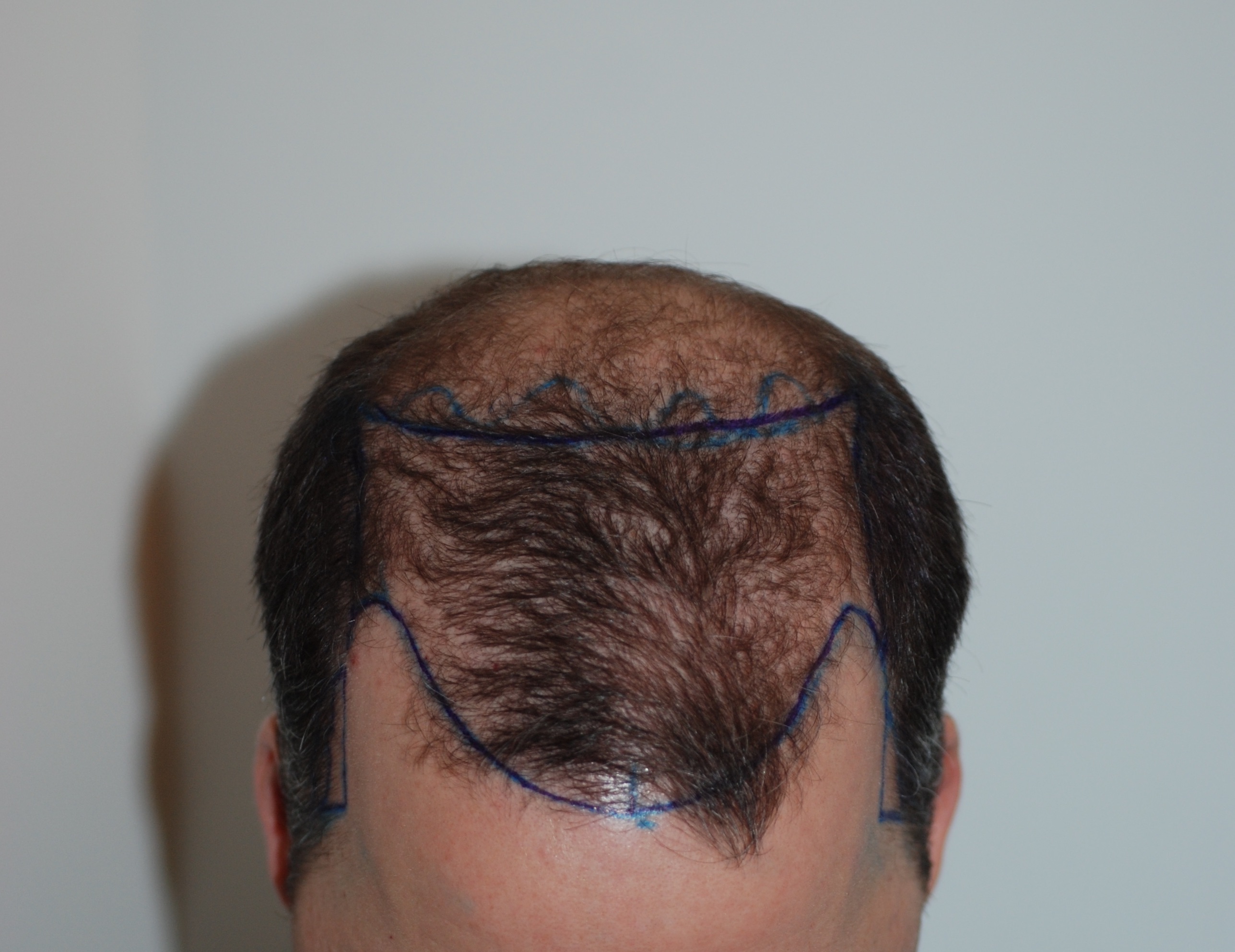 /foren/transplant/index.php?t=getfile&id=40959&private=0