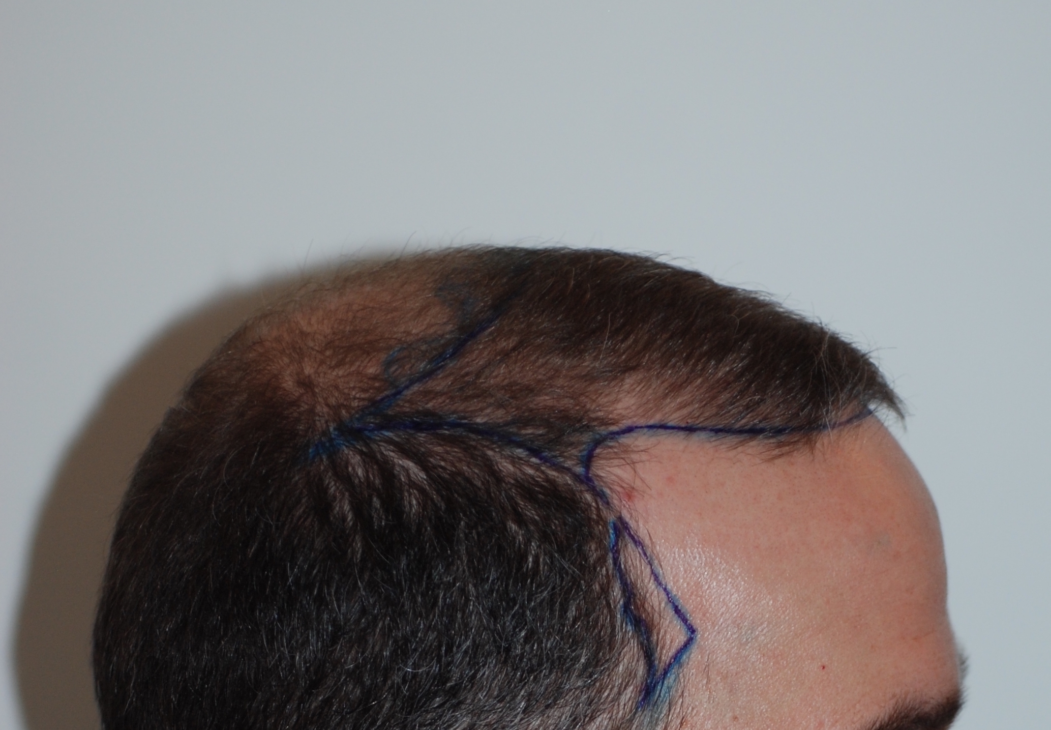 /foren/transplant/index.php?t=getfile&id=40960&private=0