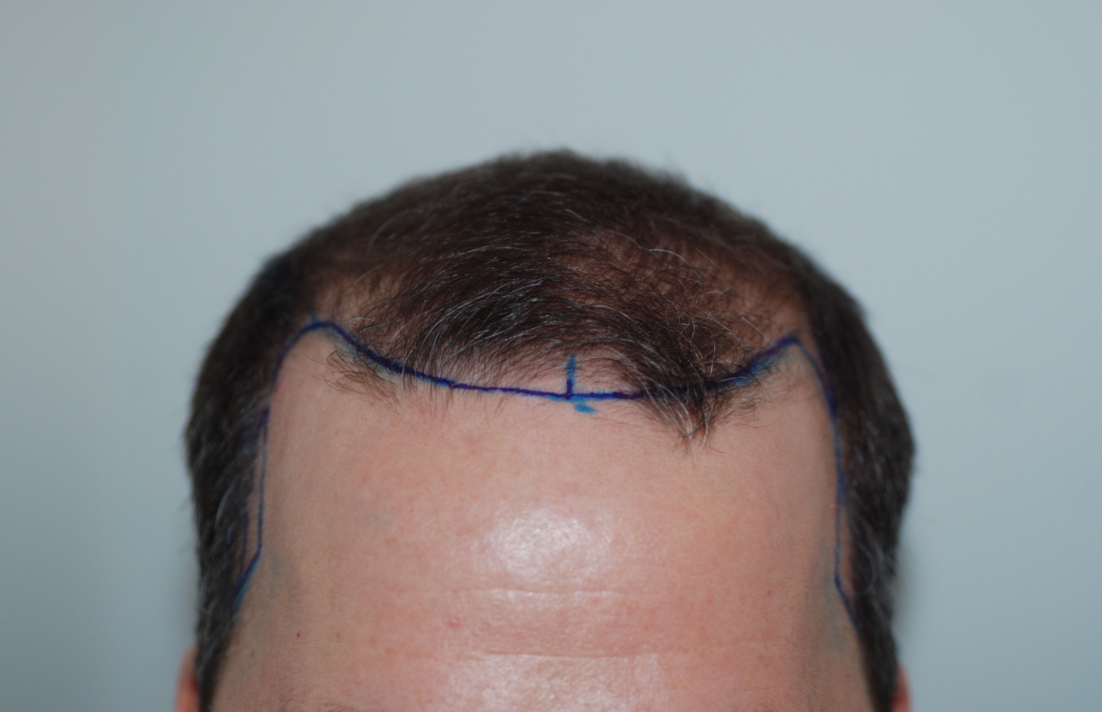 /foren/transplant/index.php?t=getfile&id=40961&private=0