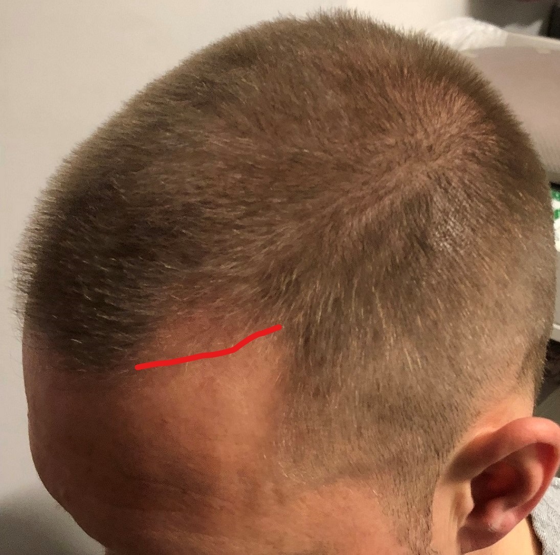 /foren/transplant/index.php?t=getfile&id=41147&private=0