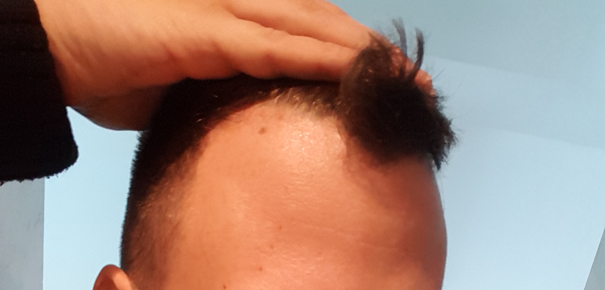 /foren/transplant/index.php?t=getfile&id=41172&private=0