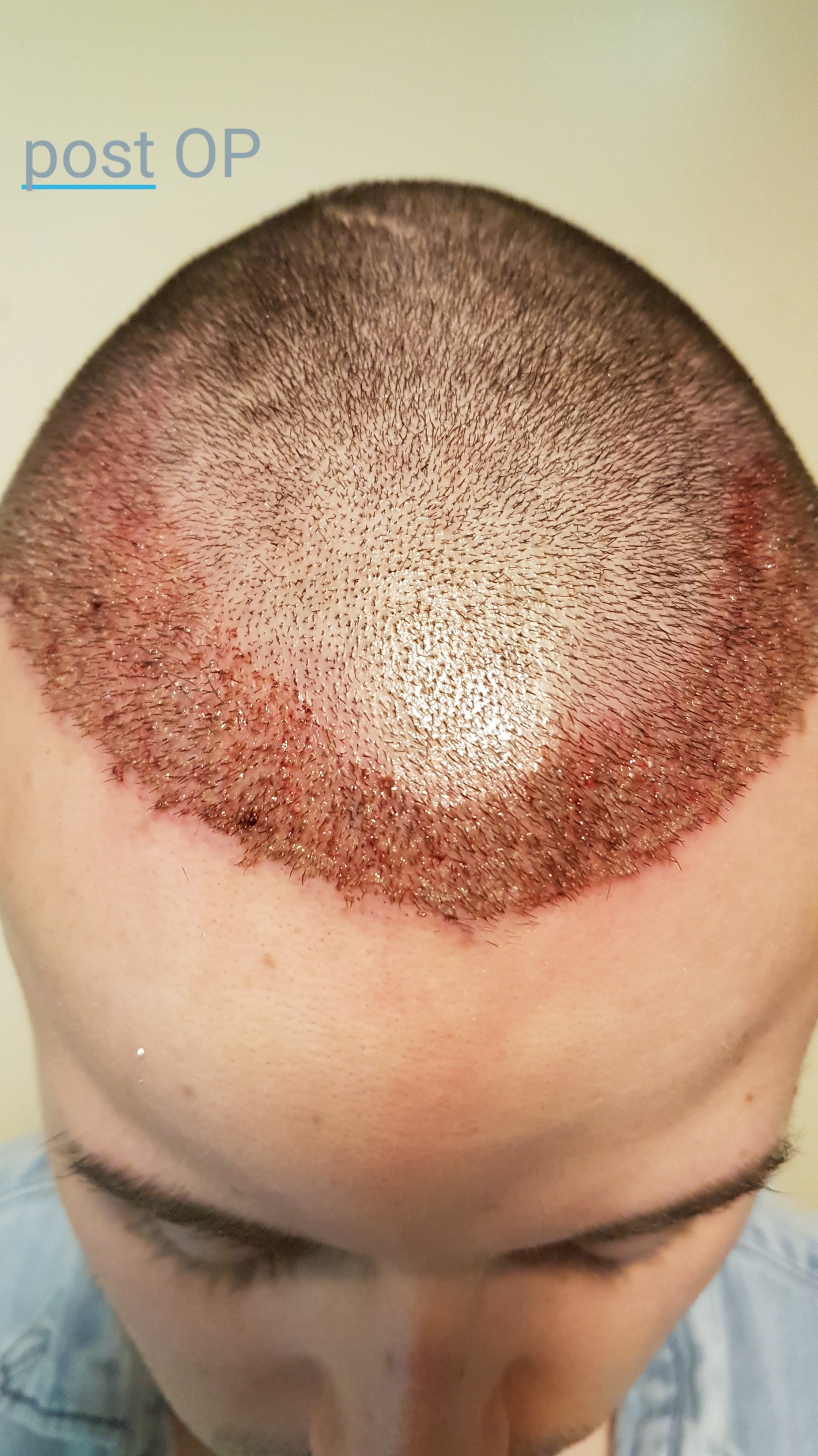 /foren/transplant/index.php?t=getfile&id=41174&private=0