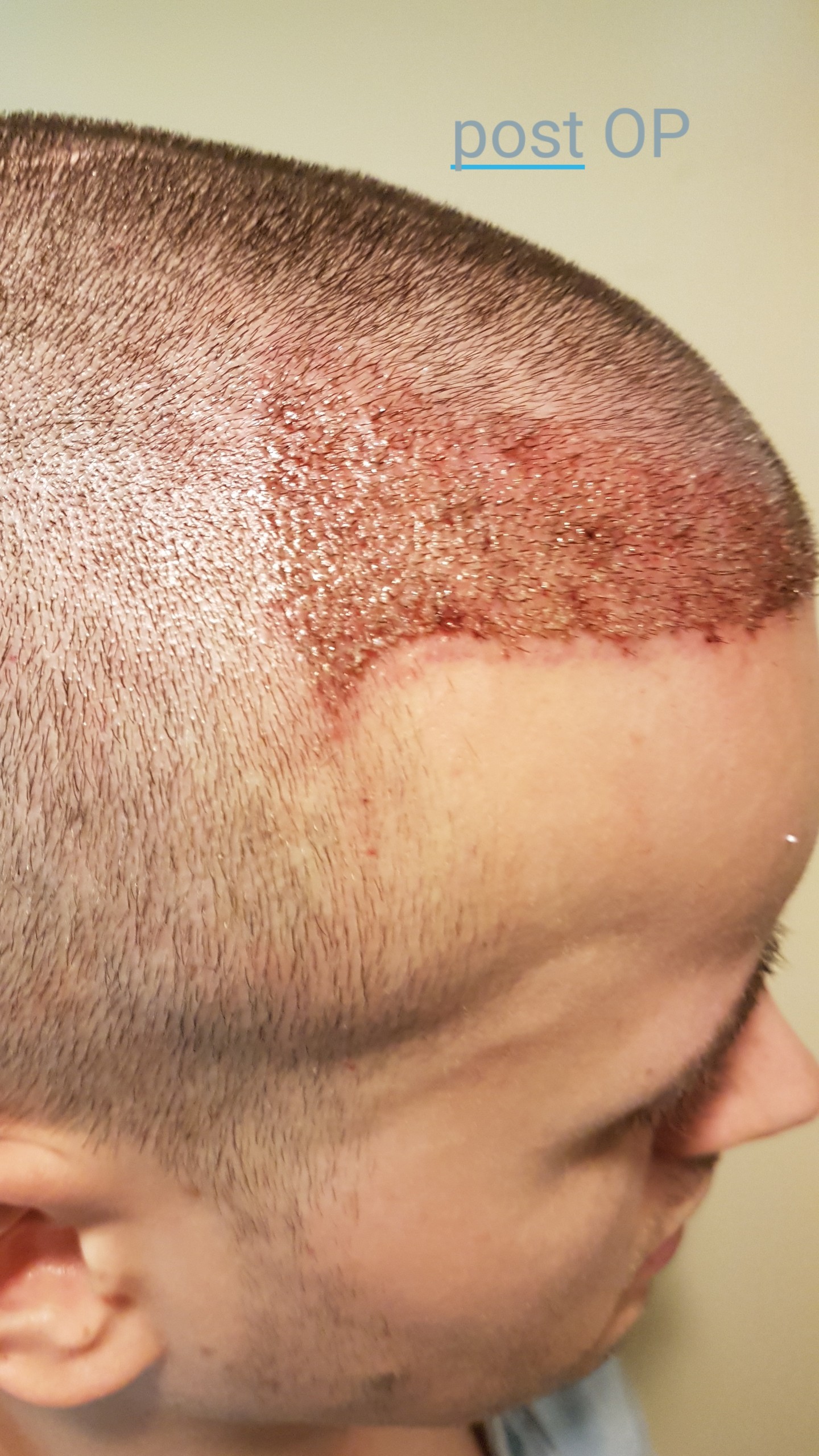 /foren/transplant/index.php?t=getfile&id=41176&private=0