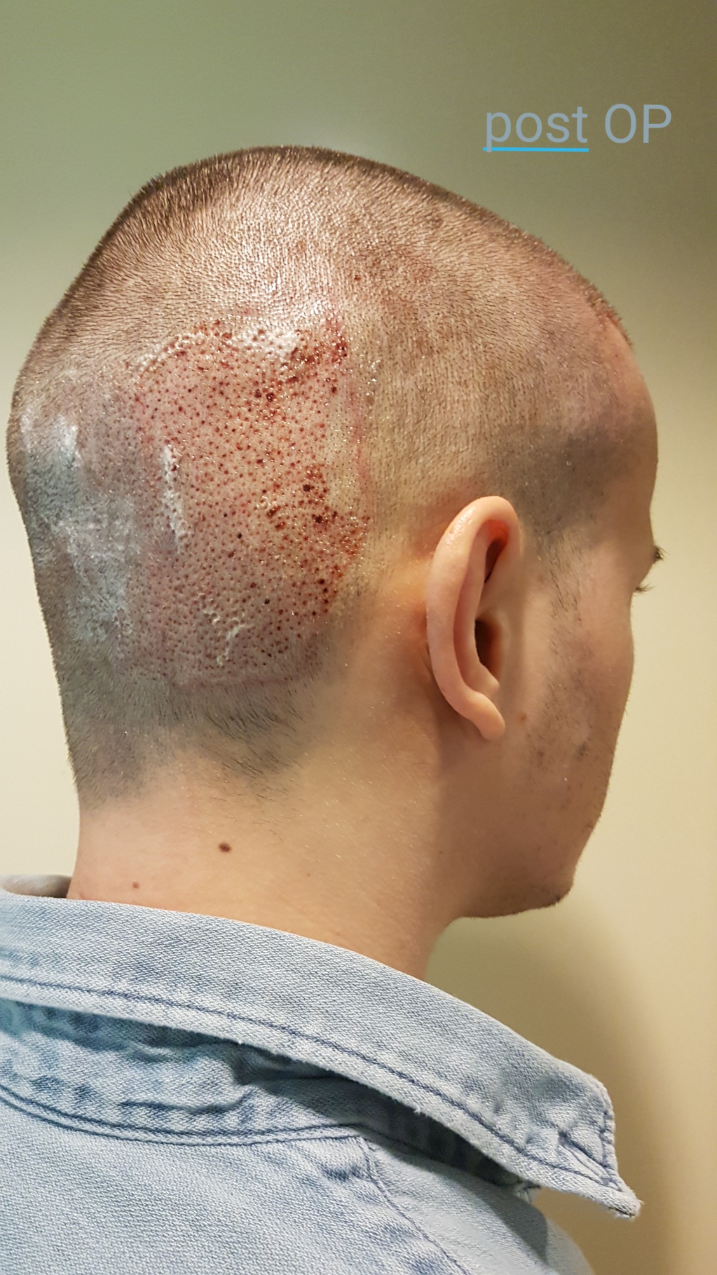 /foren/transplant/index.php?t=getfile&id=41177&private=0