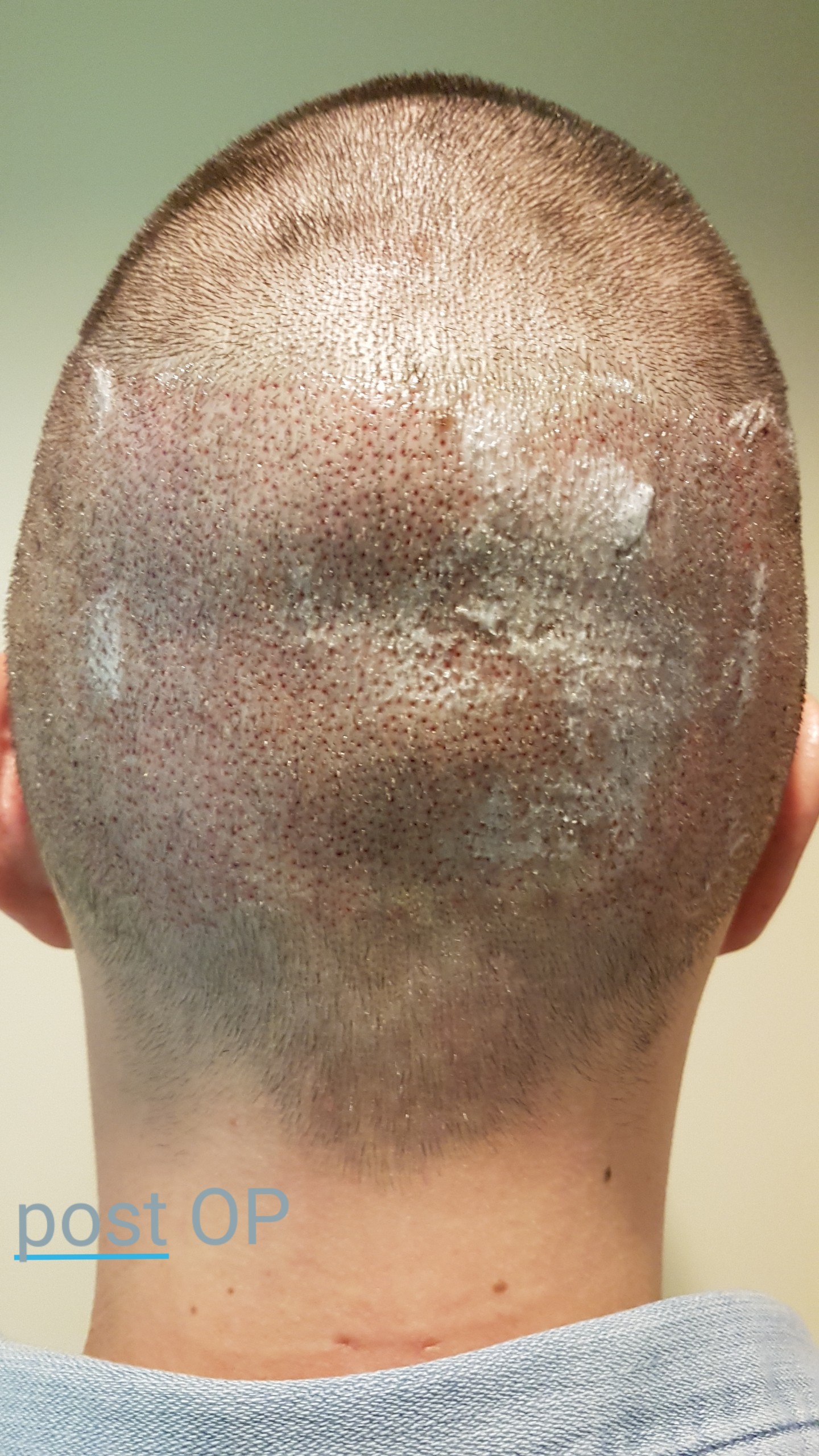 /foren/transplant/index.php?t=getfile&id=41178&private=0