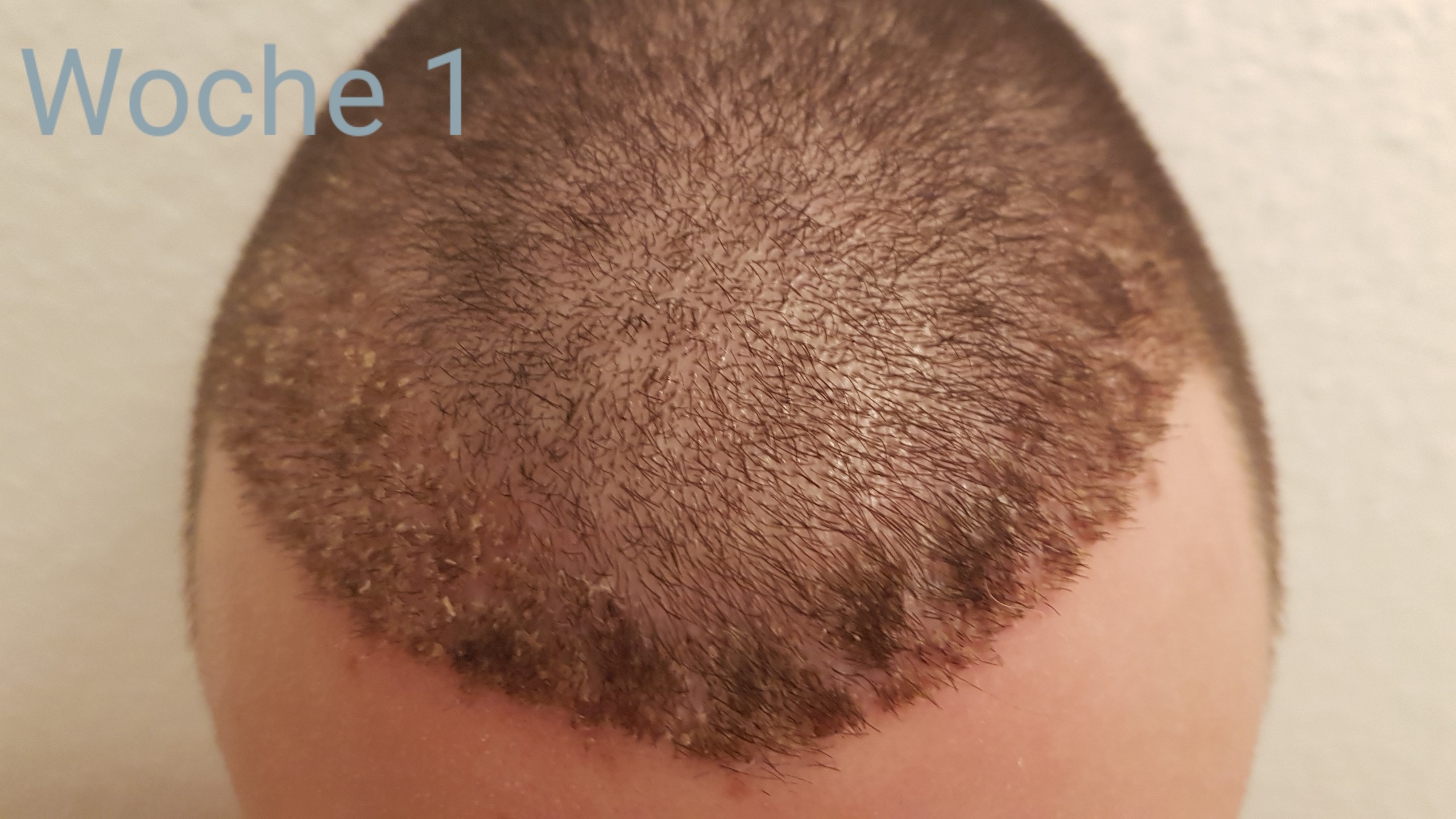 /foren/transplant/index.php?t=getfile&id=41179&private=0