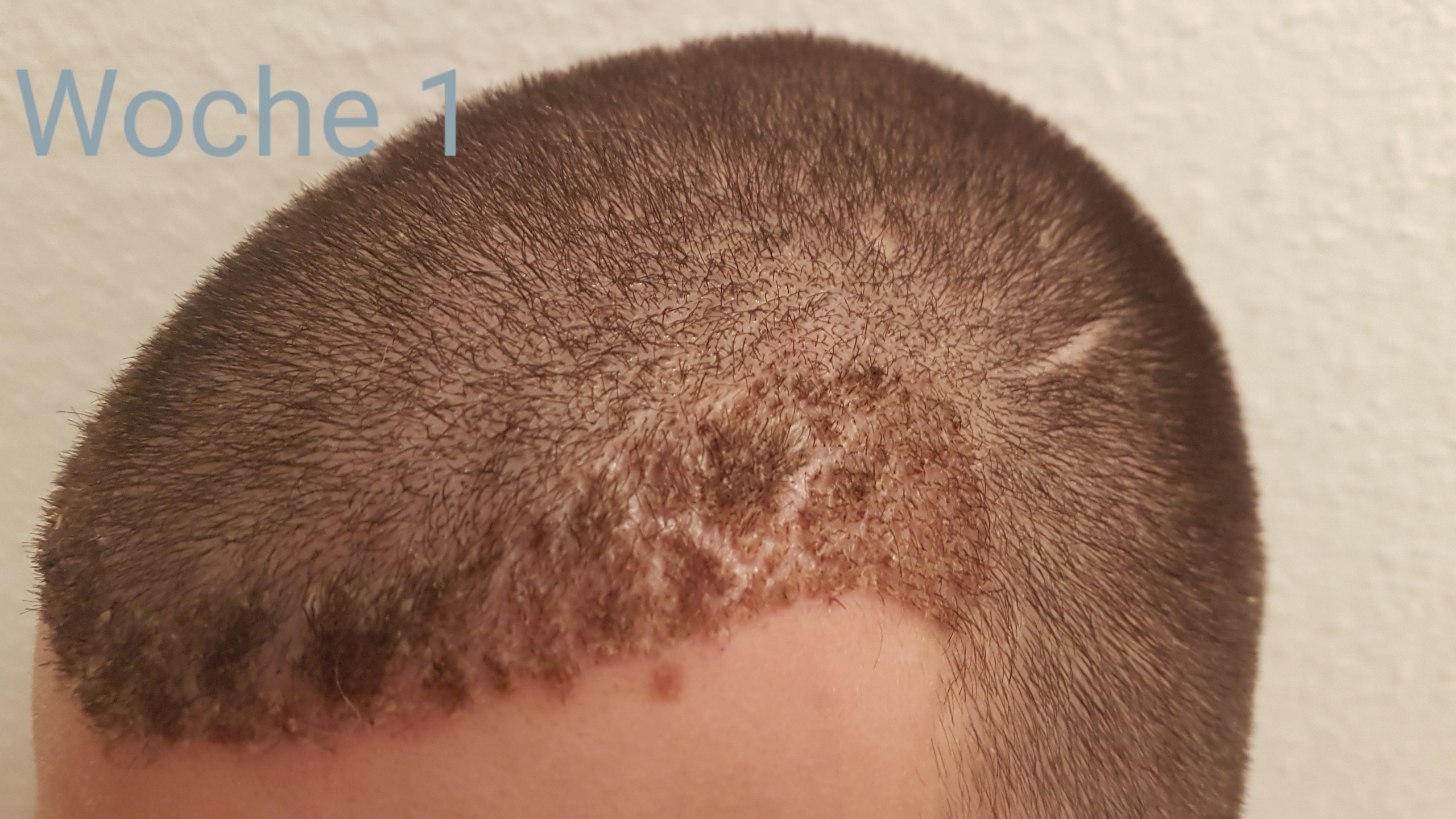 /foren/transplant/index.php?t=getfile&id=41180&private=0