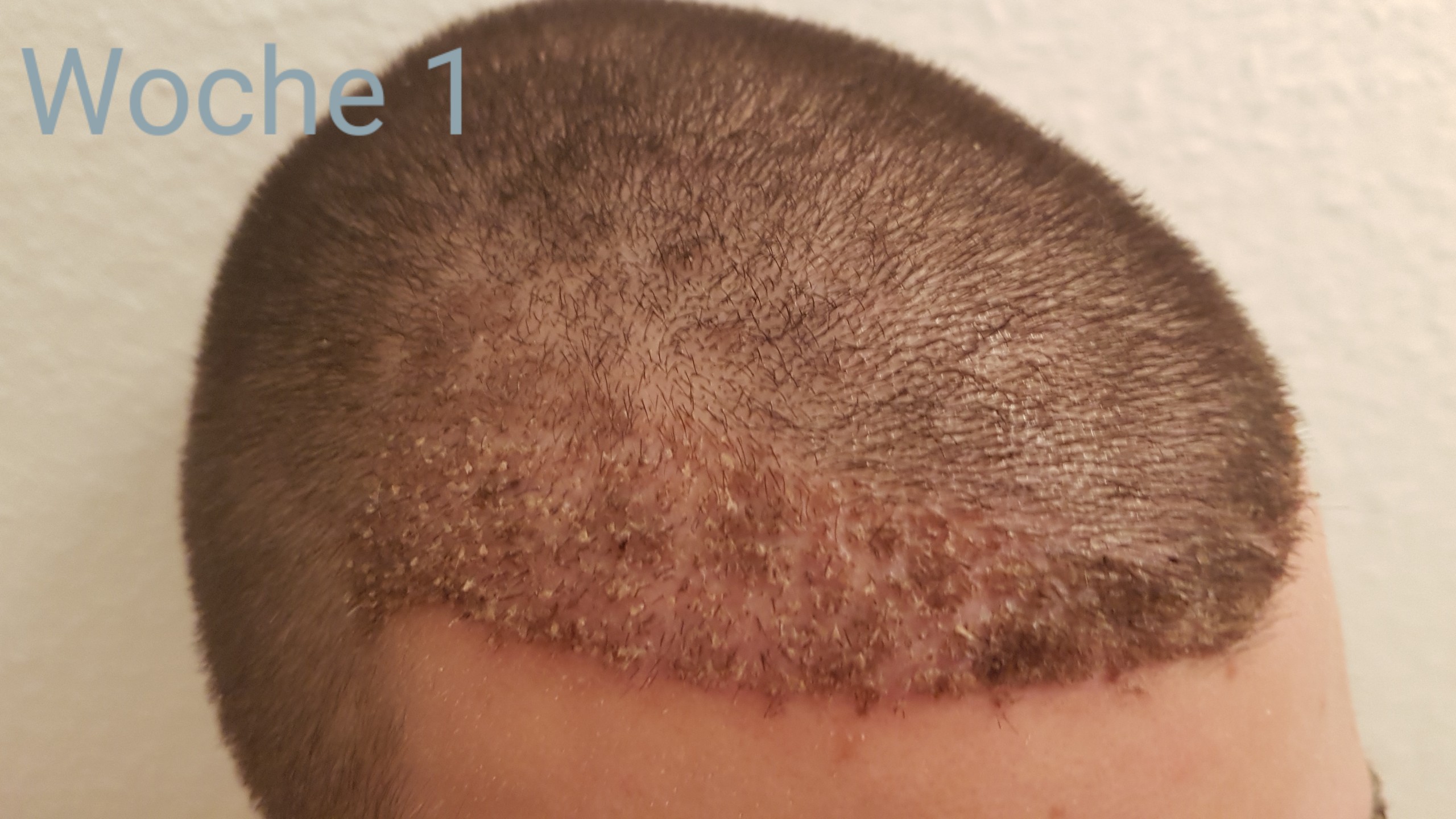 /foren/transplant/index.php?t=getfile&id=41181&private=0