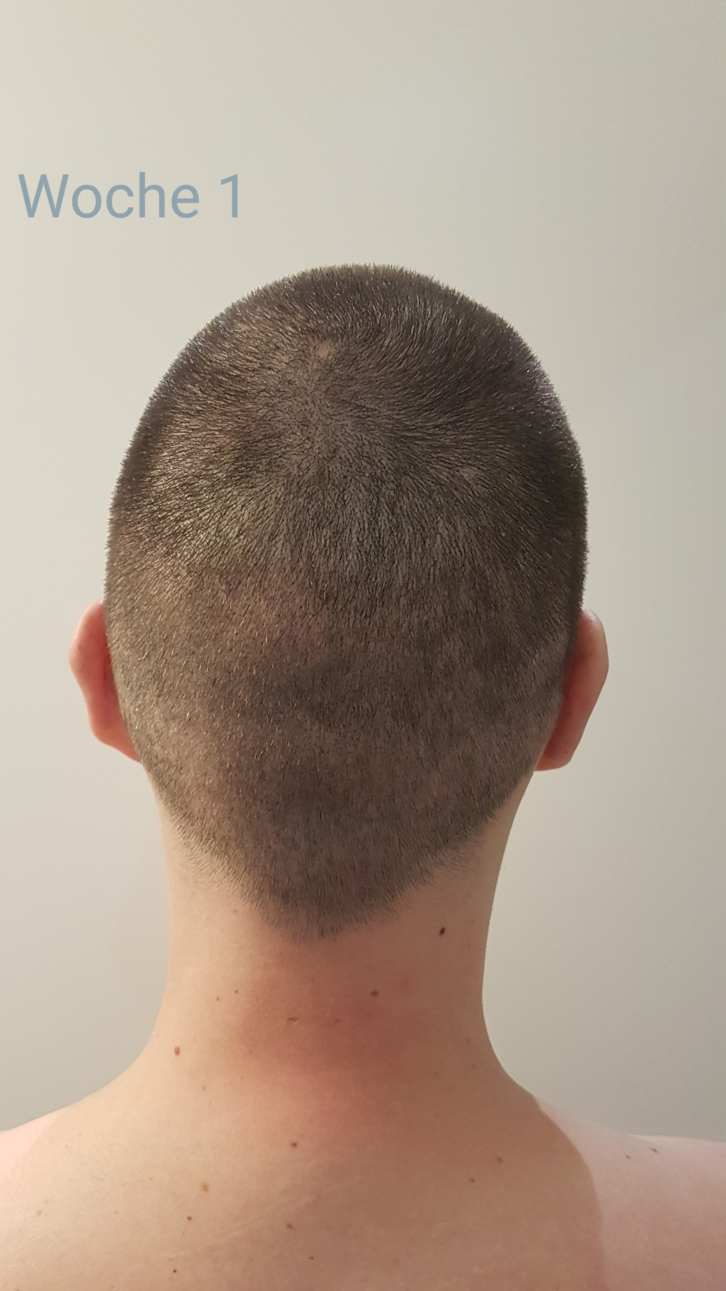 /foren/transplant/index.php?t=getfile&id=41183&private=0