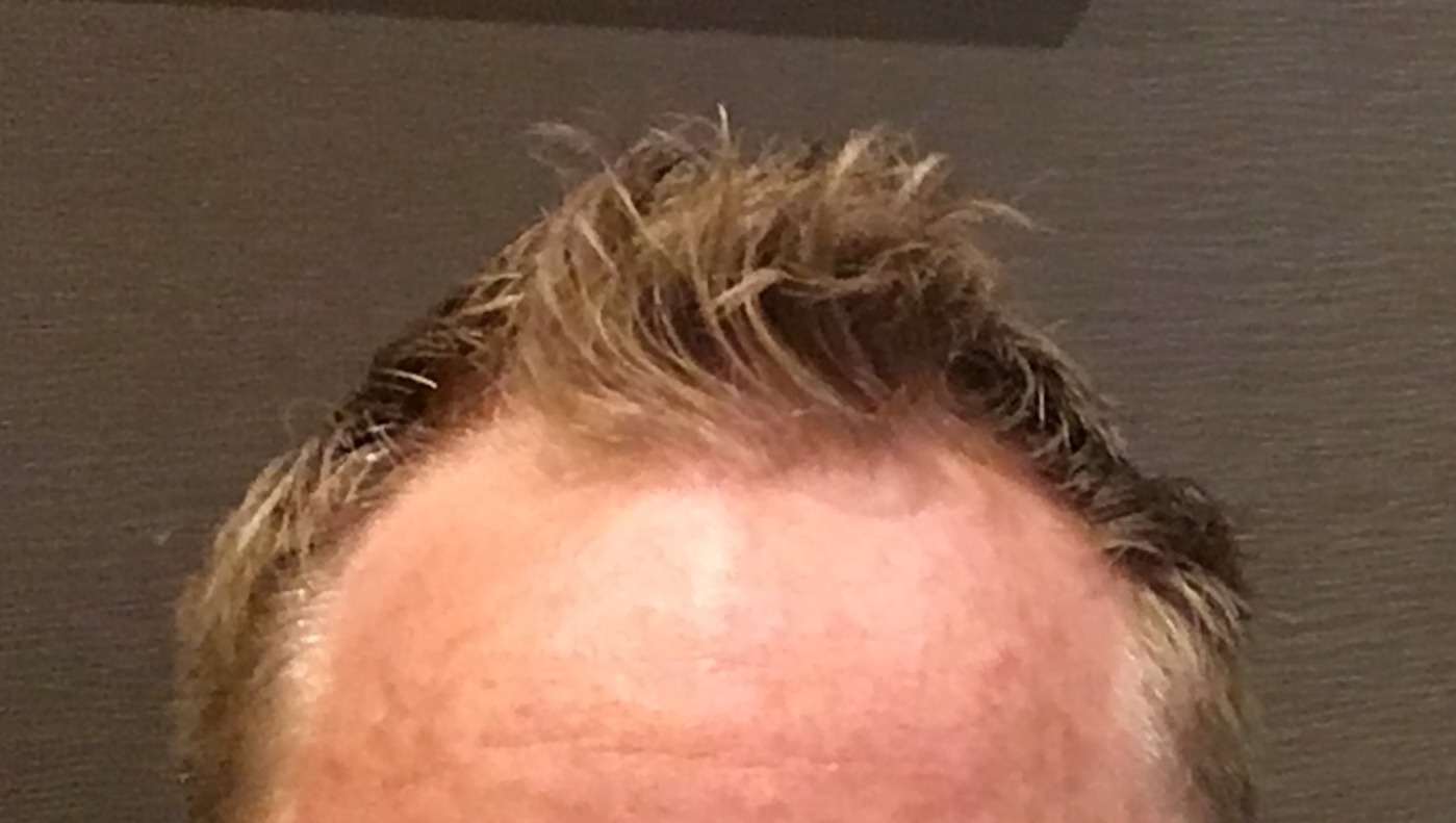 /foren/transplant/index.php?t=getfile&id=41196&private=0