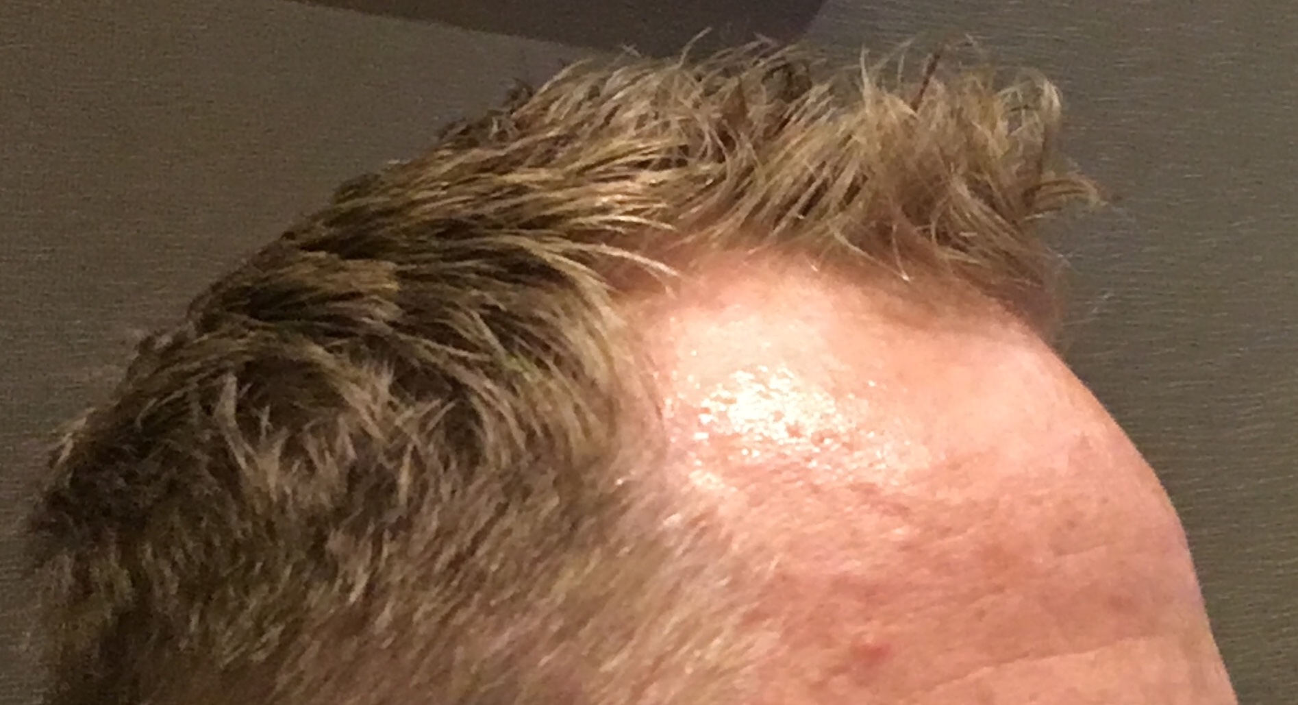 /foren/transplant/index.php?t=getfile&id=41198&private=0