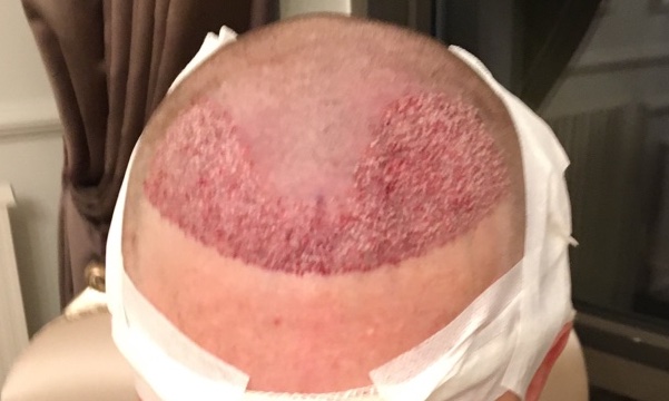 /foren/transplant/index.php?t=getfile&id=41199&private=0