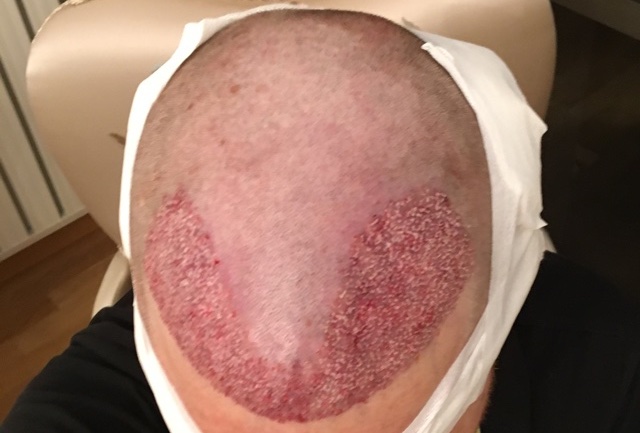 /foren/transplant/index.php?t=getfile&id=41200&private=0