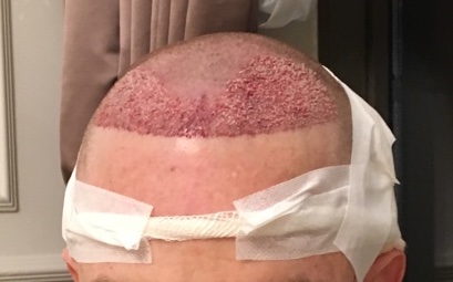 /foren/transplant/index.php?t=getfile&id=41201&private=0