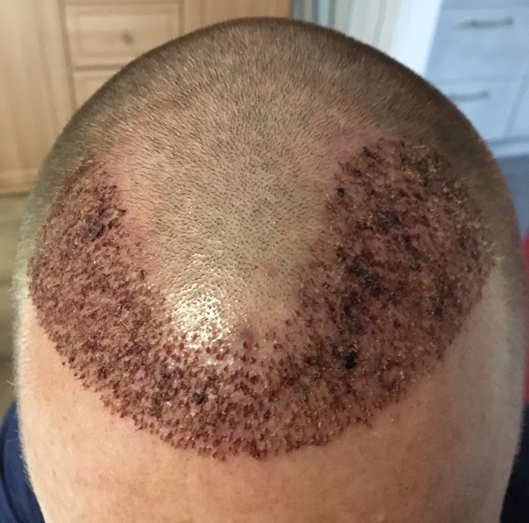 /foren/transplant/index.php?t=getfile&id=41202&private=0