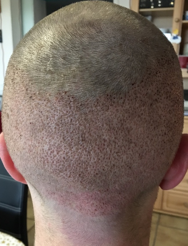 /foren/transplant/index.php?t=getfile&id=41203&private=0